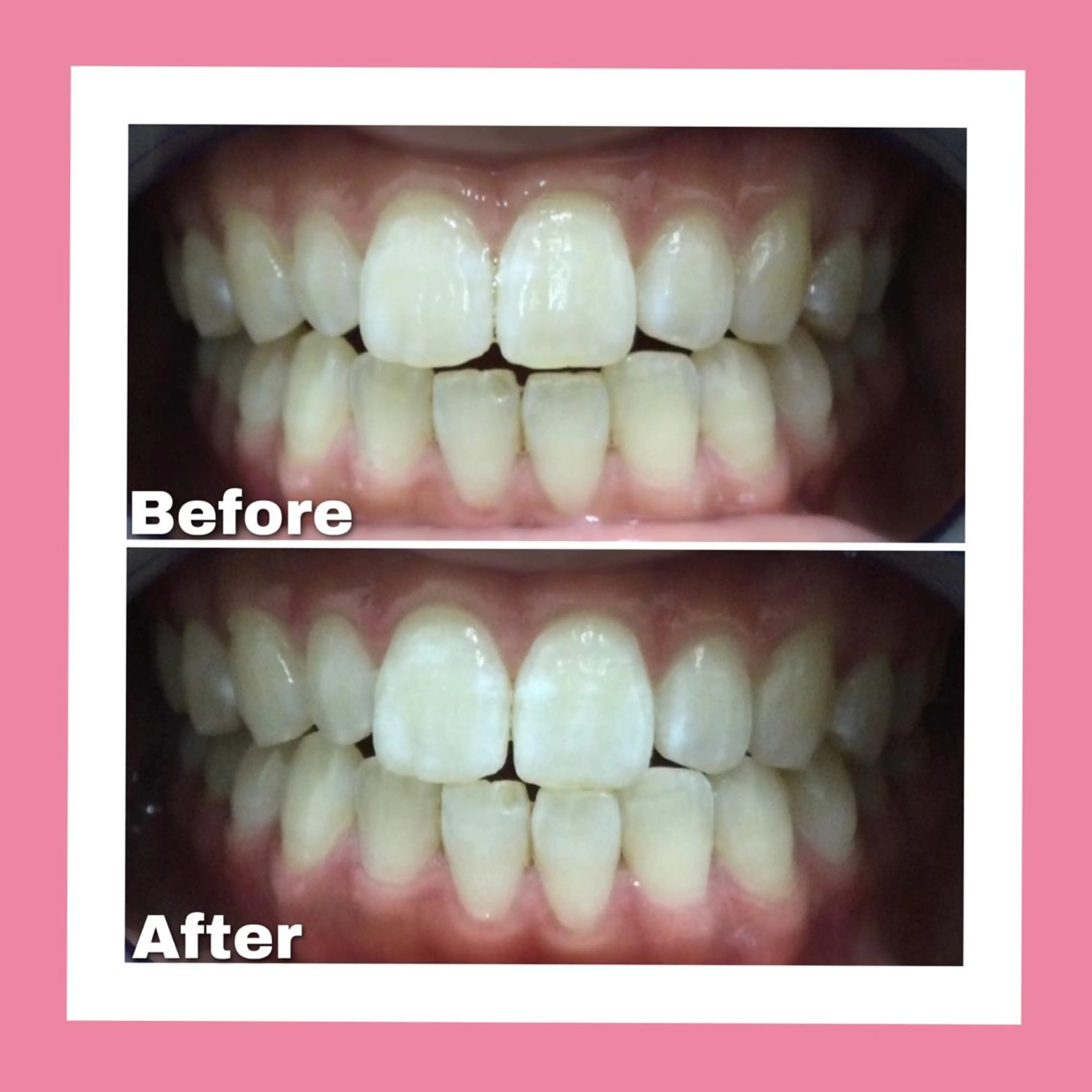 Briller 浜松のエステ・リラクイメージ