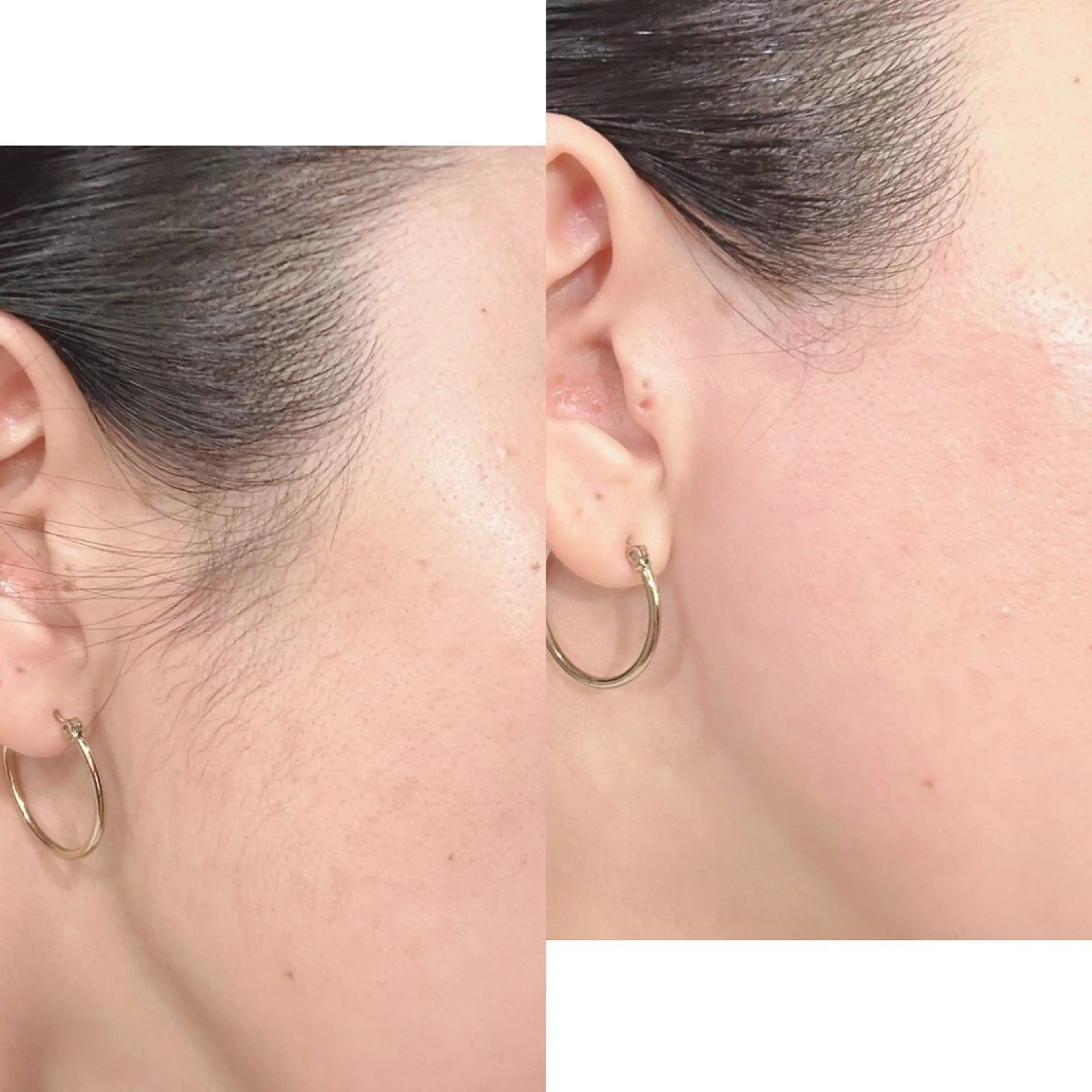 脱毛 KOHOLA -ワックス脱毛専門-のエステ・リラクイメージ