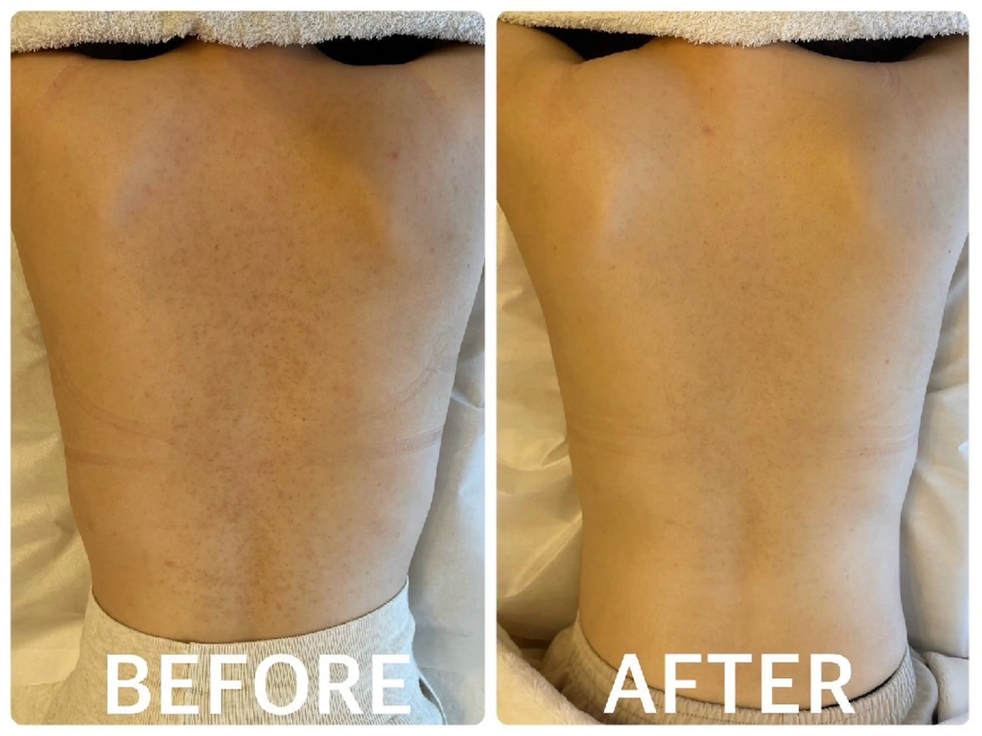 ハーブピーリング横浜 肌質改善専門店のその他イメージ