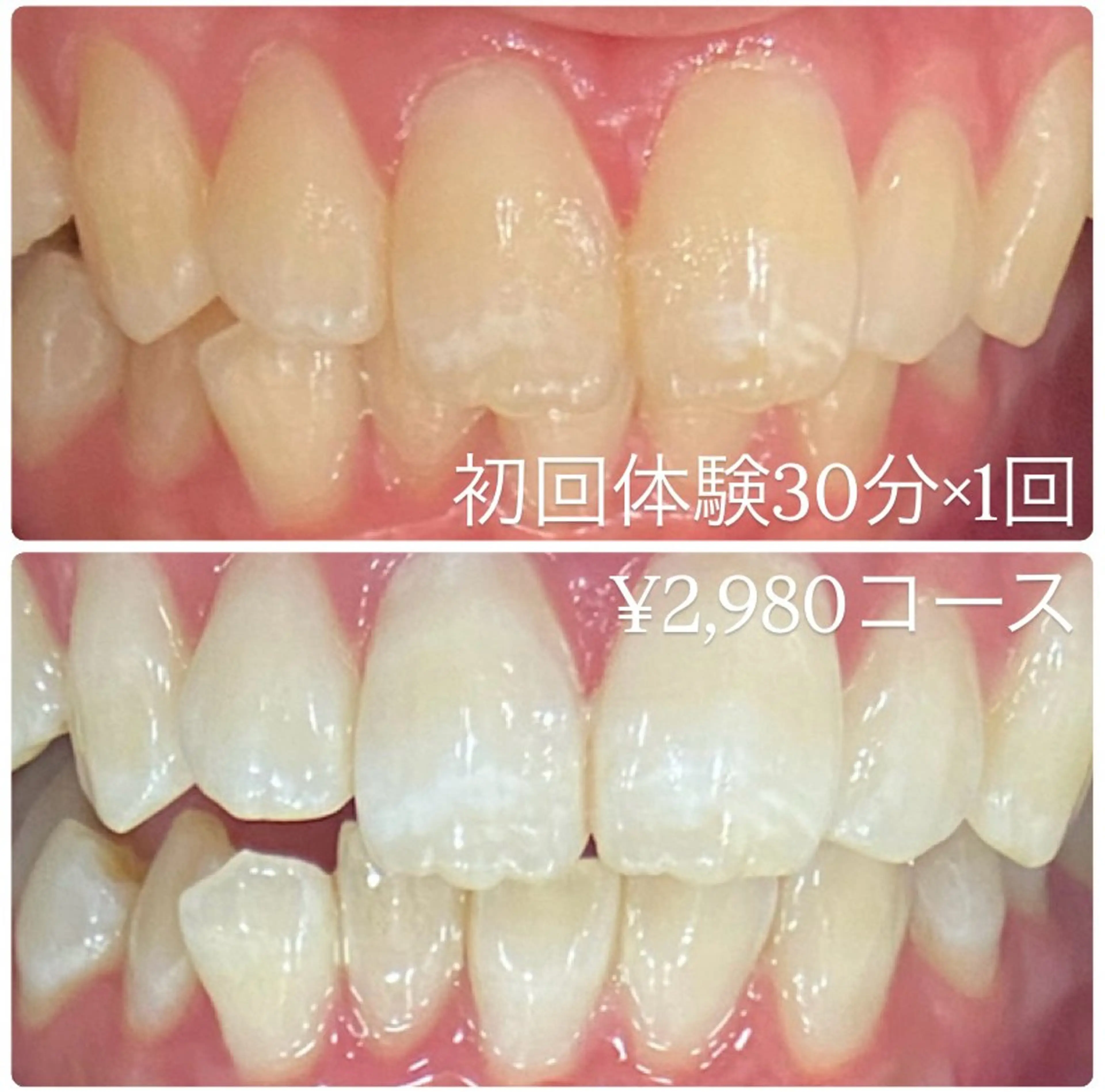 ホワイトニングルーム 横浜店のその他イメージ