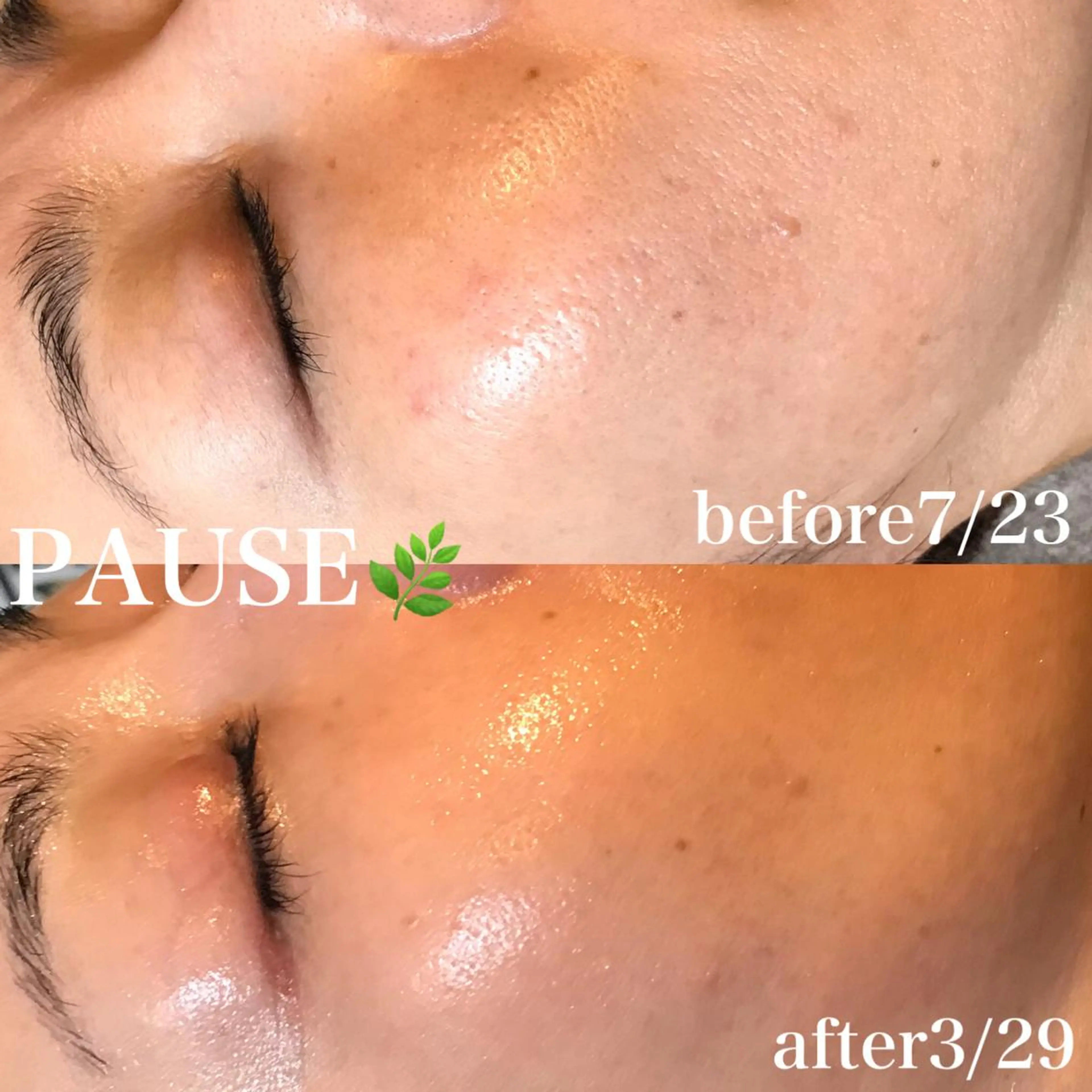 エステ 浜野 恵美のエステ・リラクイメージ