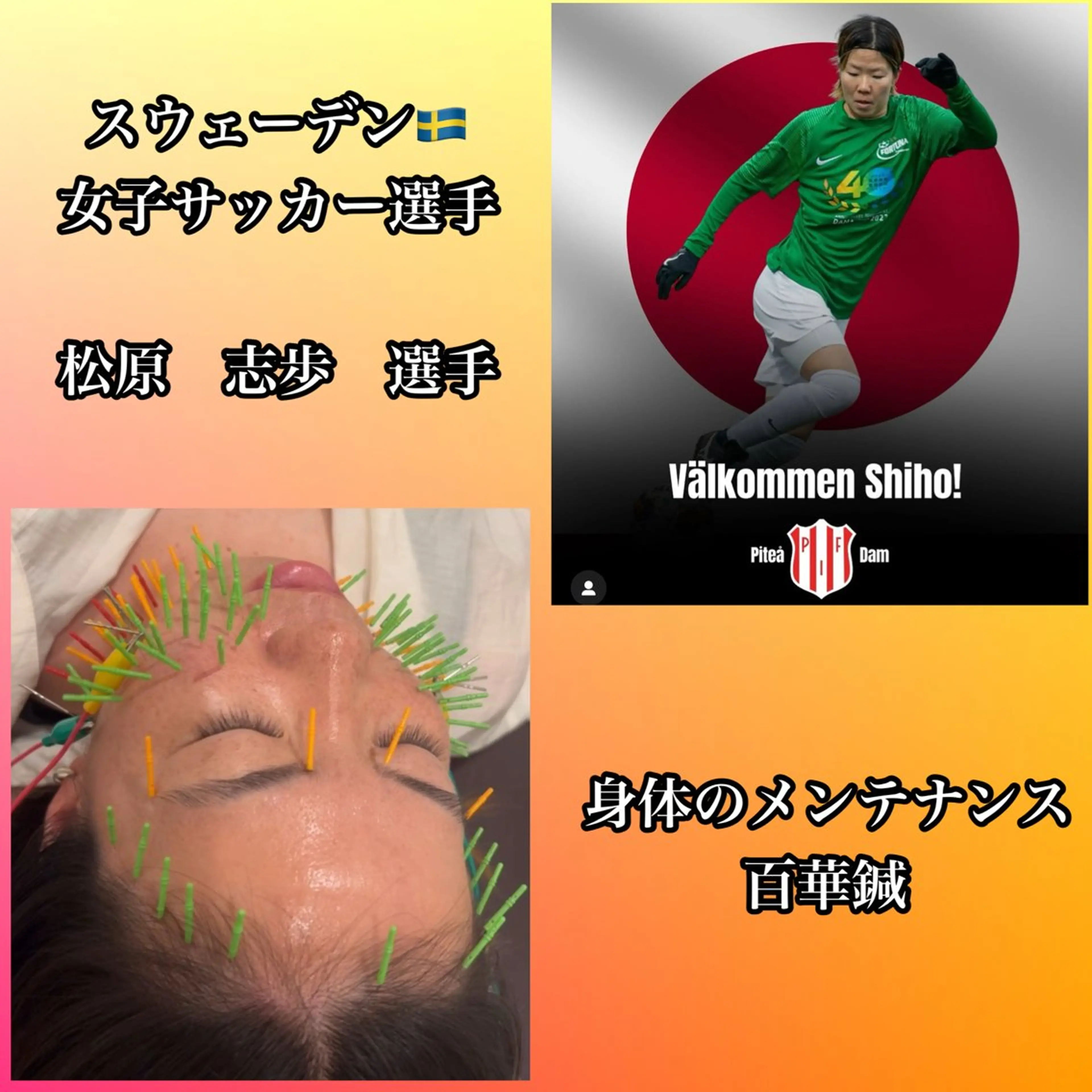 エステ リラク 肌質改善×美容鍼 ゆいのエステ・リラクイメージ