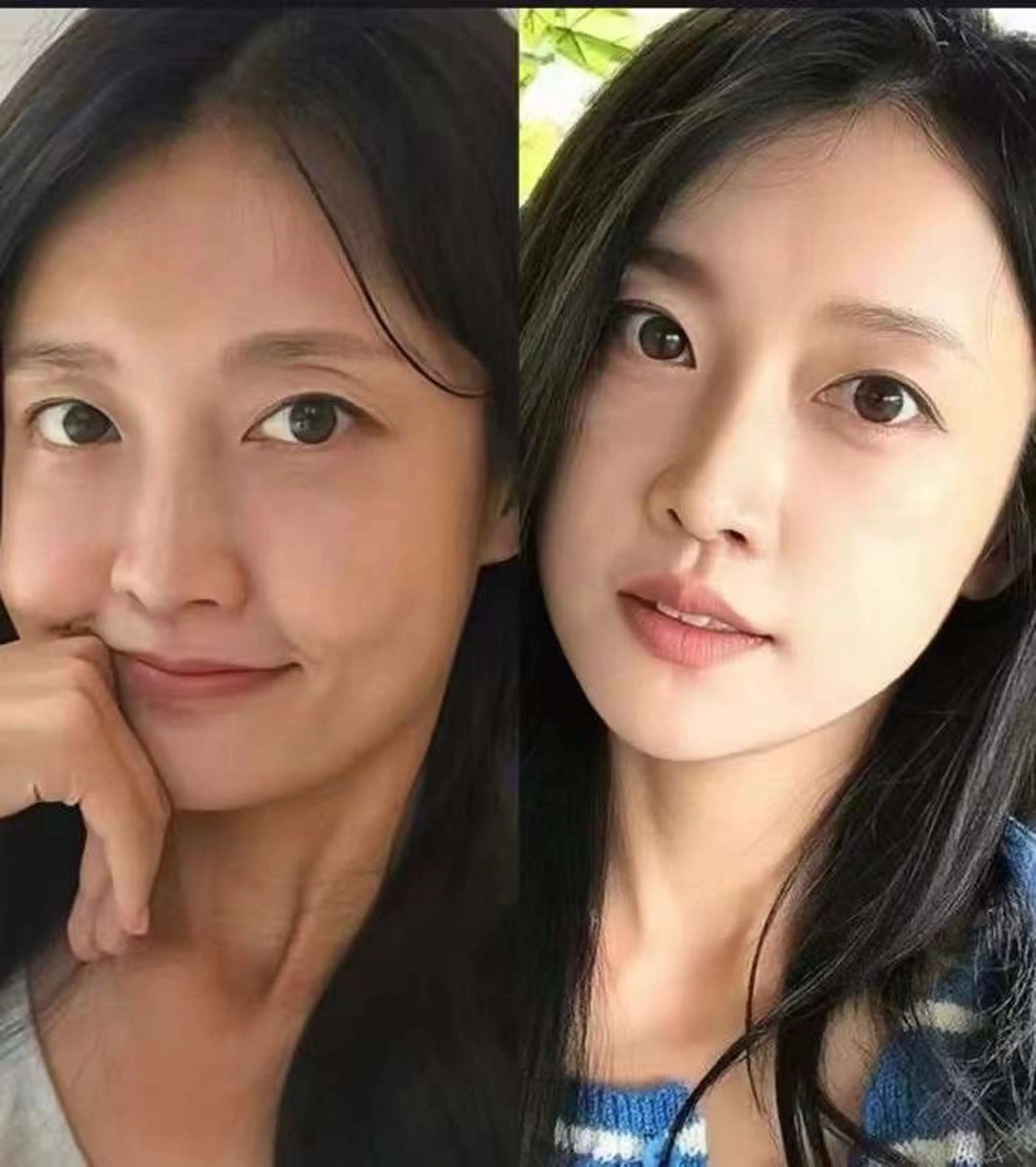 ネイル エステ aliaハイフ&水光ジェットサロン所属・aliaハーブ水光店 エステティシャン募集のエステ・リラクイメージ