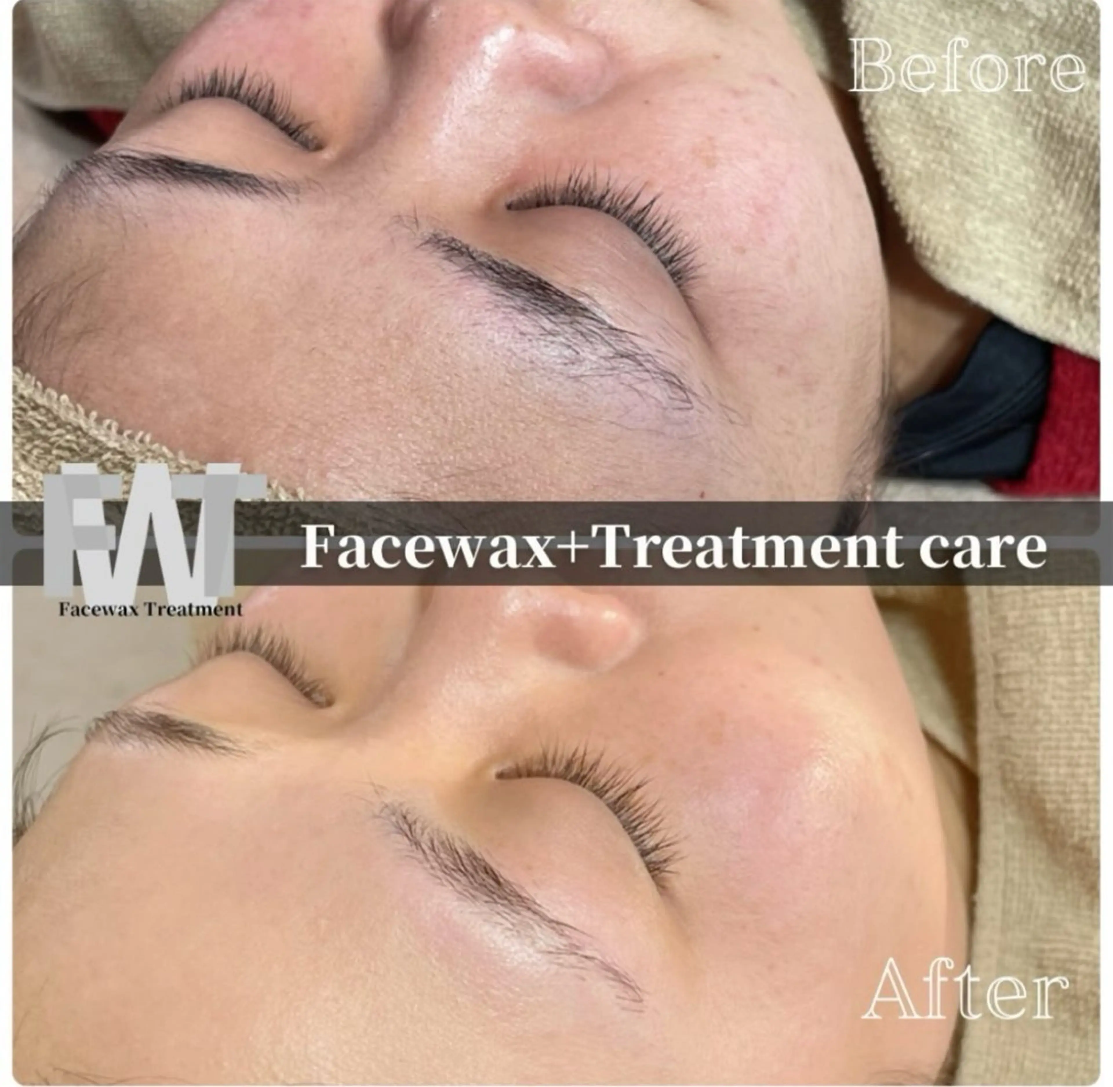 【韓国美容✨炭酸パック付き】スペシャル潤艶フェイスWAXの写真