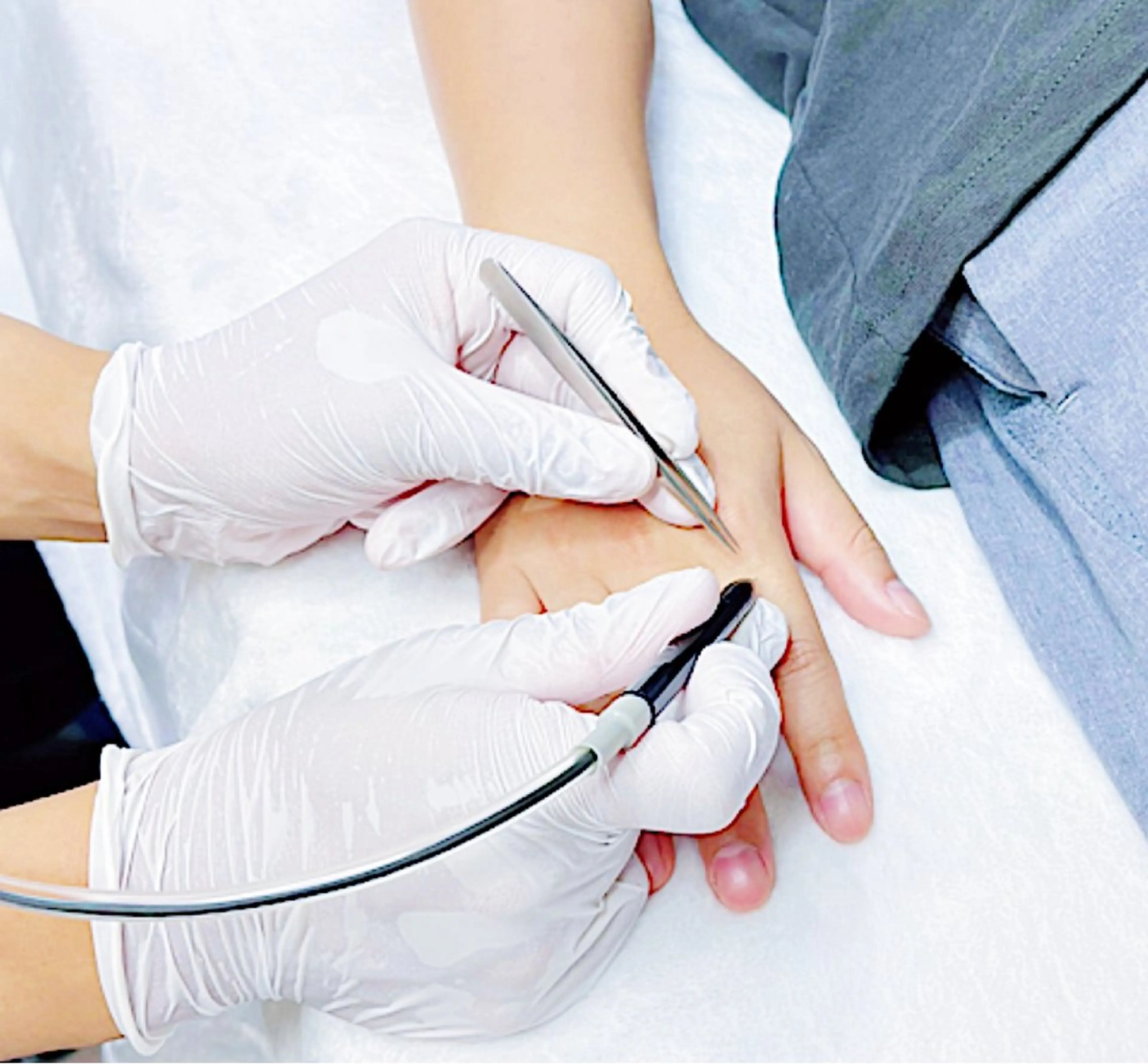 メンズ 脱毛 【一本ずつ脱毛】 ReMove 柏のエステ・リラクイメージ