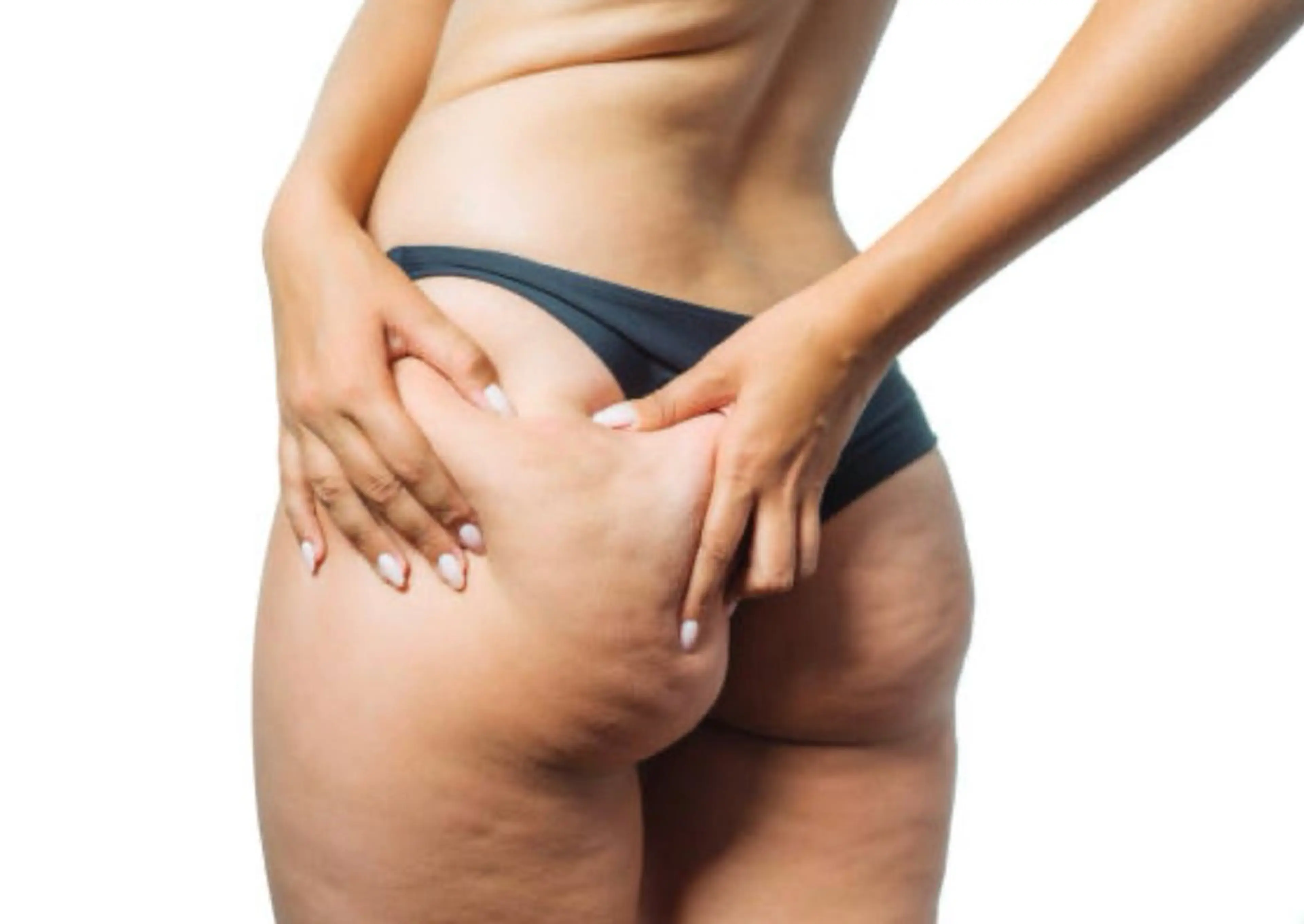 もっと減量促進90分コースの写真