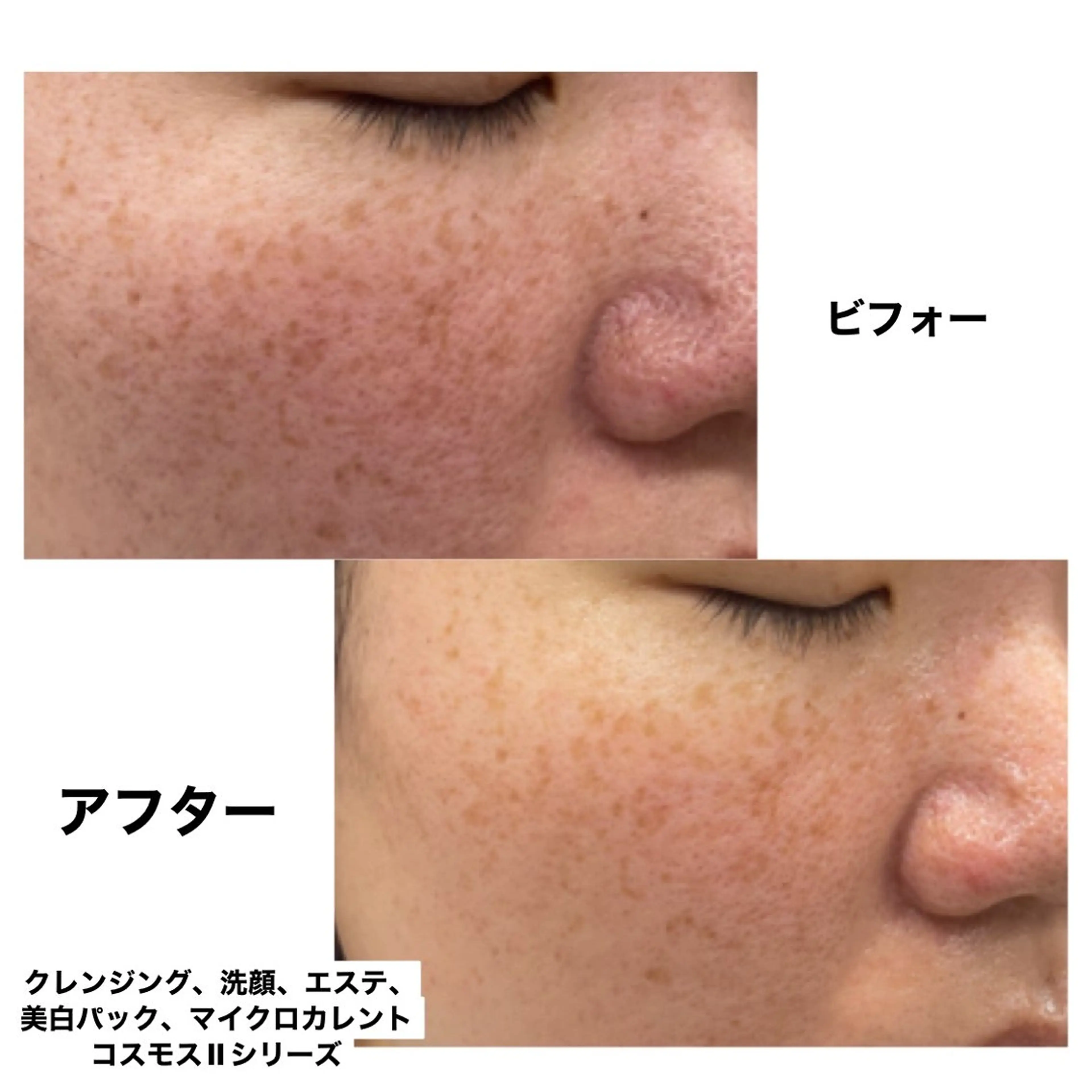 Coco Calin 𓇼山脇愛のエステ・リラクイメージ