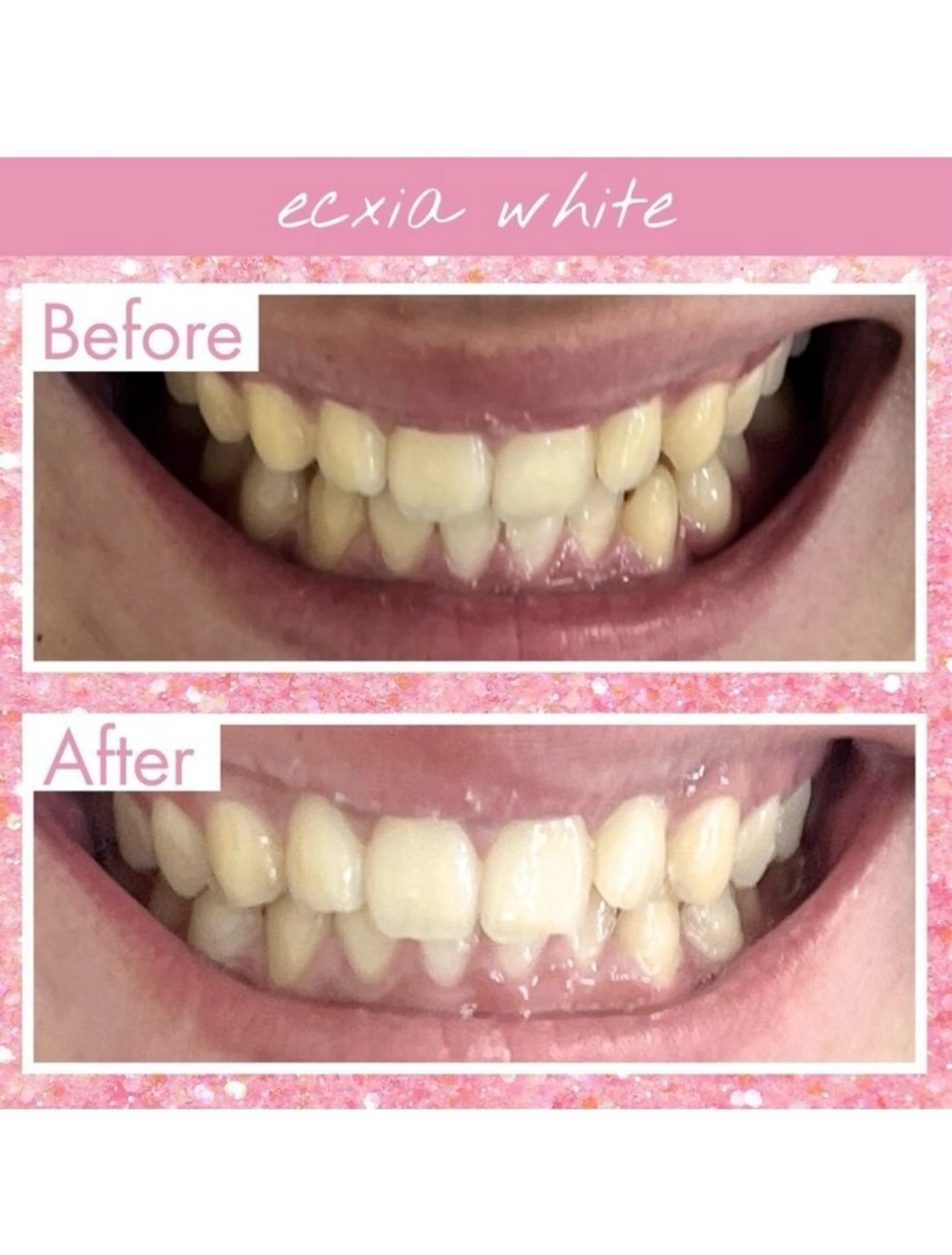 エクシアホワイト西尾 堀内恵のその他イメージ