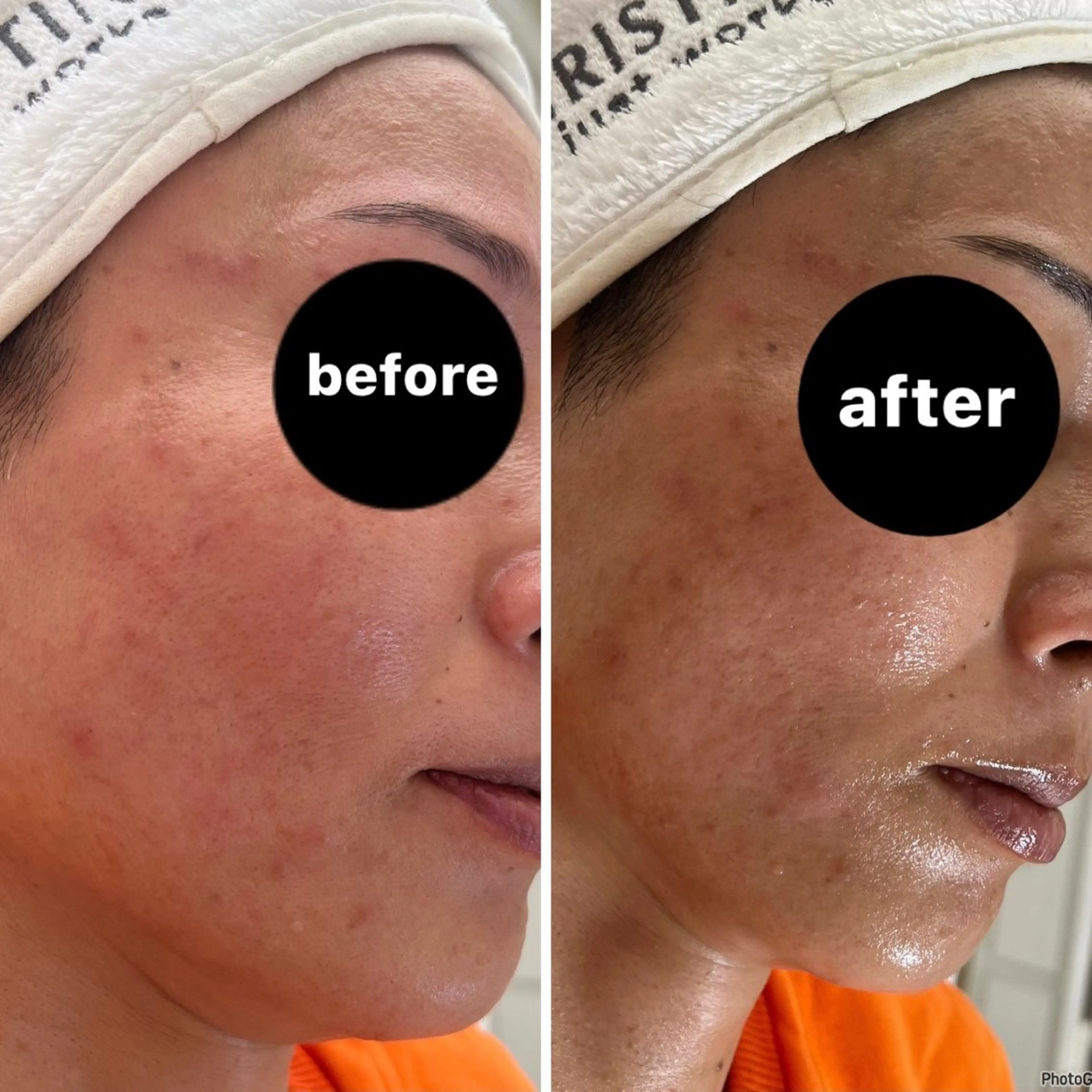 エステ HBL💖 Sakuraの眉毛・アイブロウイメージ