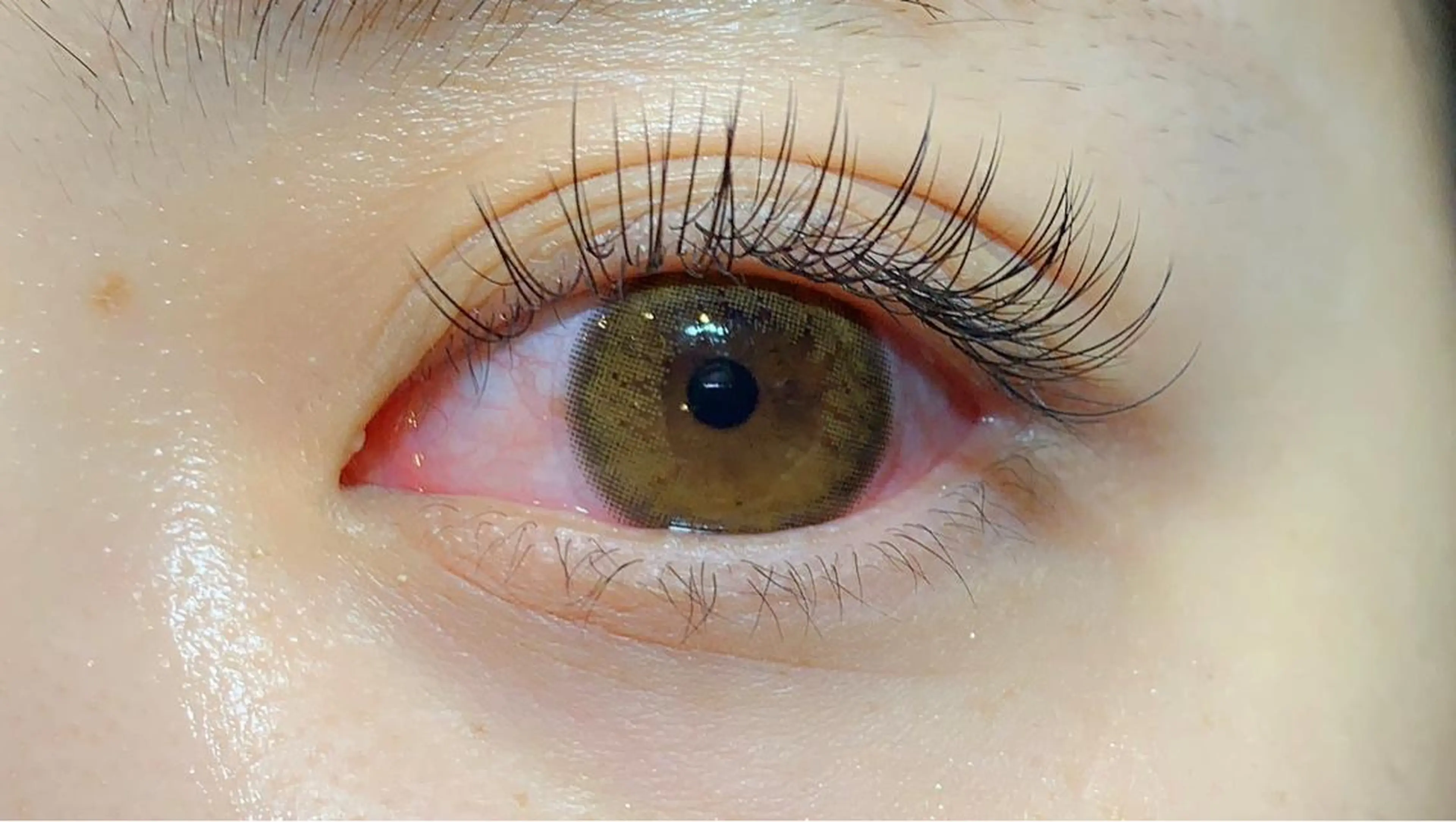 フラットマットラッシュ100本の写真