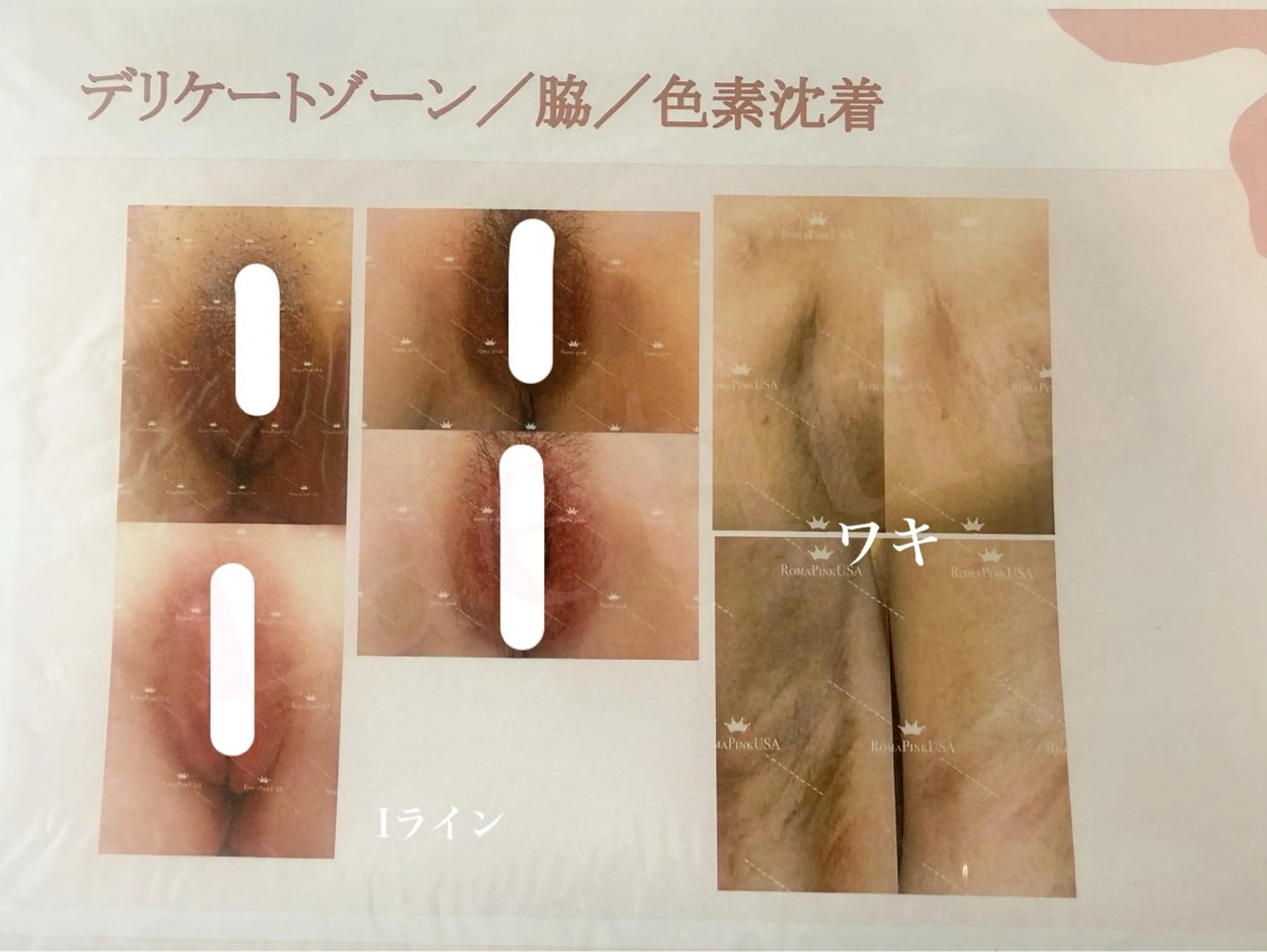 エステ レティティア秋葉原店 Yoshizawaのエステ・リラクイメージ