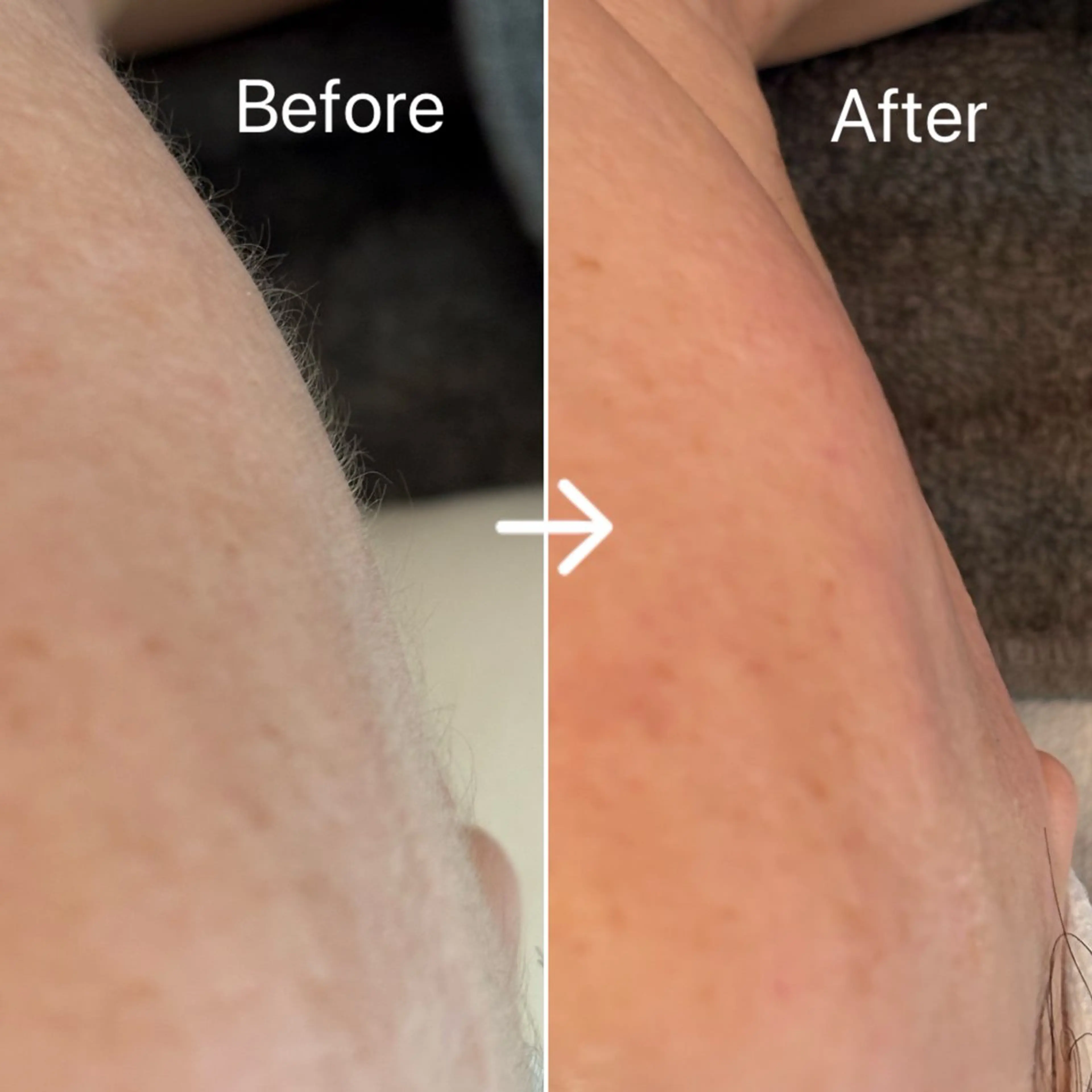 Blue Moon 【ブルームーン】のエステ・リラクイメージ