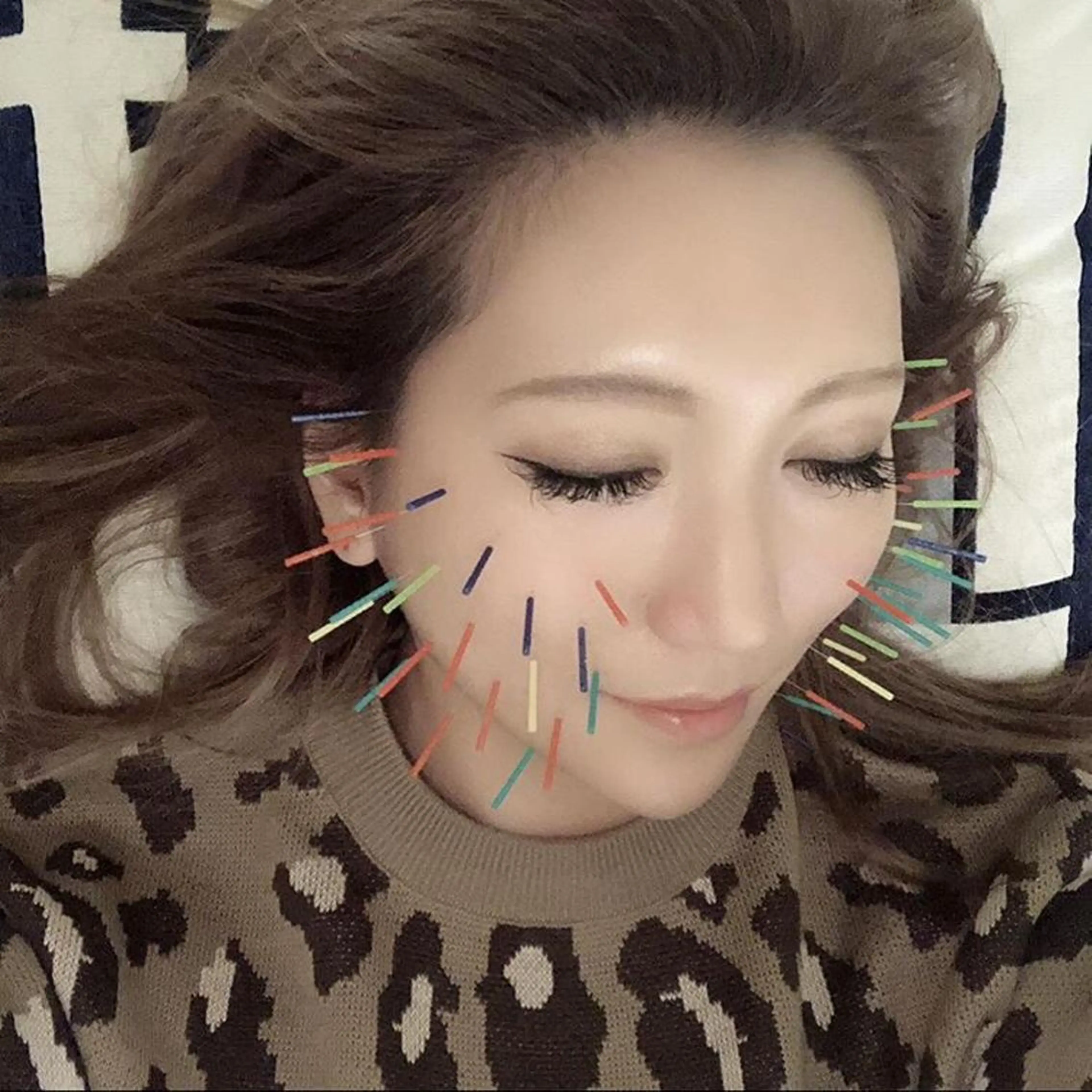 鍼灸整骨院Refine所属・鍼灸 Refineのその他イメージ