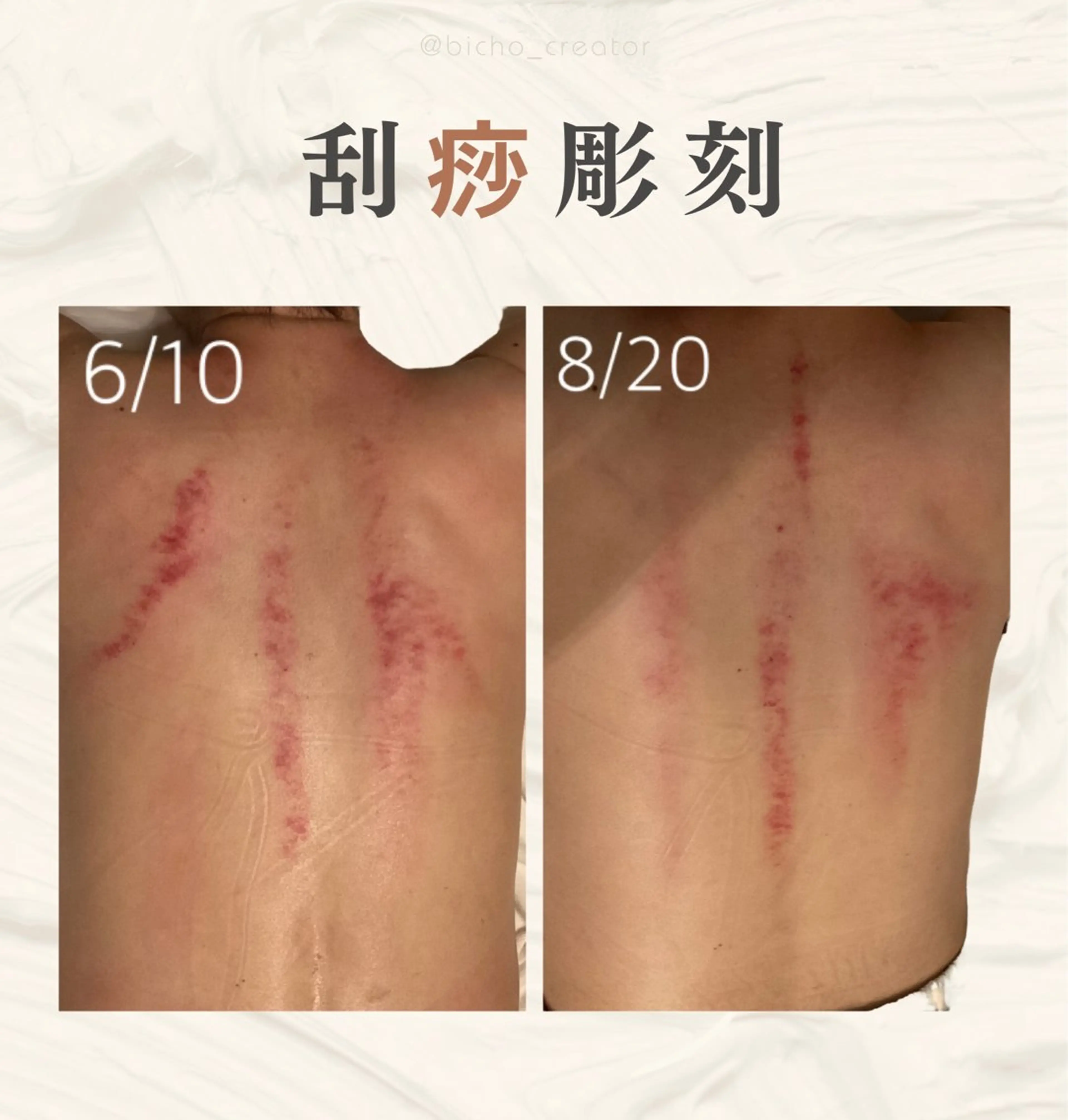 美腸専門 漢方よもぎ蒸しのエステ・リラクイメージ