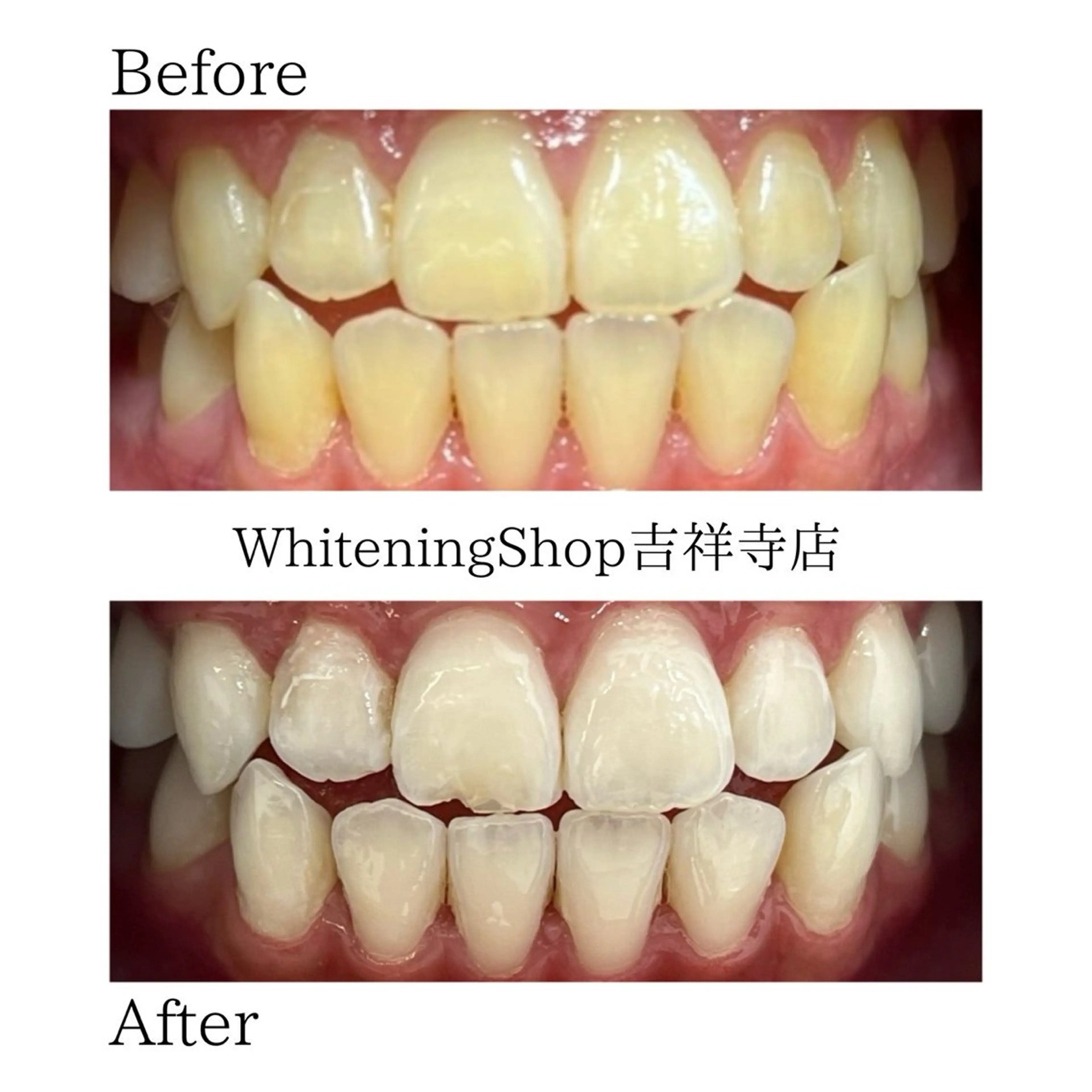 エステ リラク ホワイトニング ショップ吉祥寺店のエステ・リラクイメージ