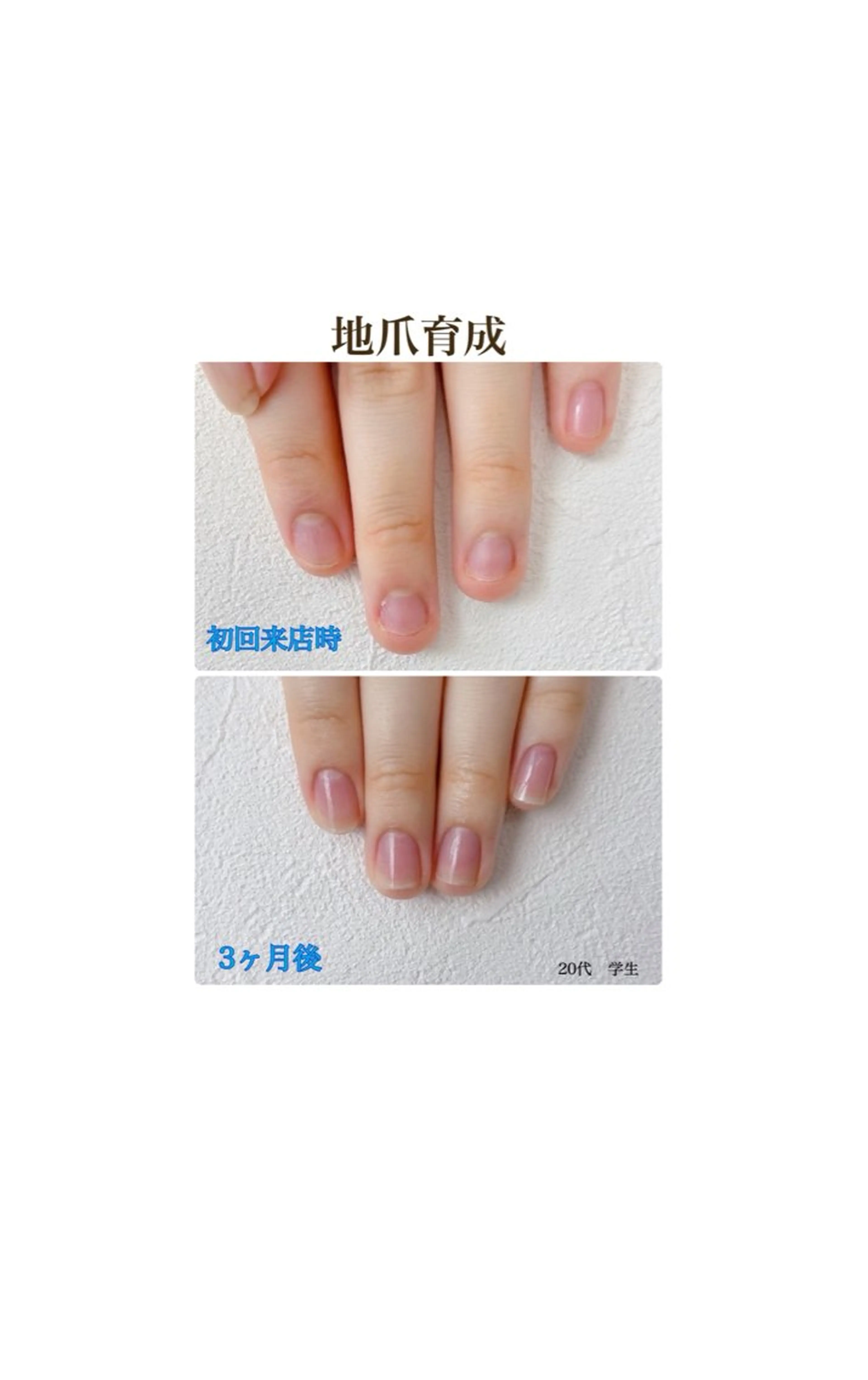 最強のネイルケア✨地爪のお悩みにさようなら❣️お試し1回¥5.800❗️モニター募集中‼️の写真