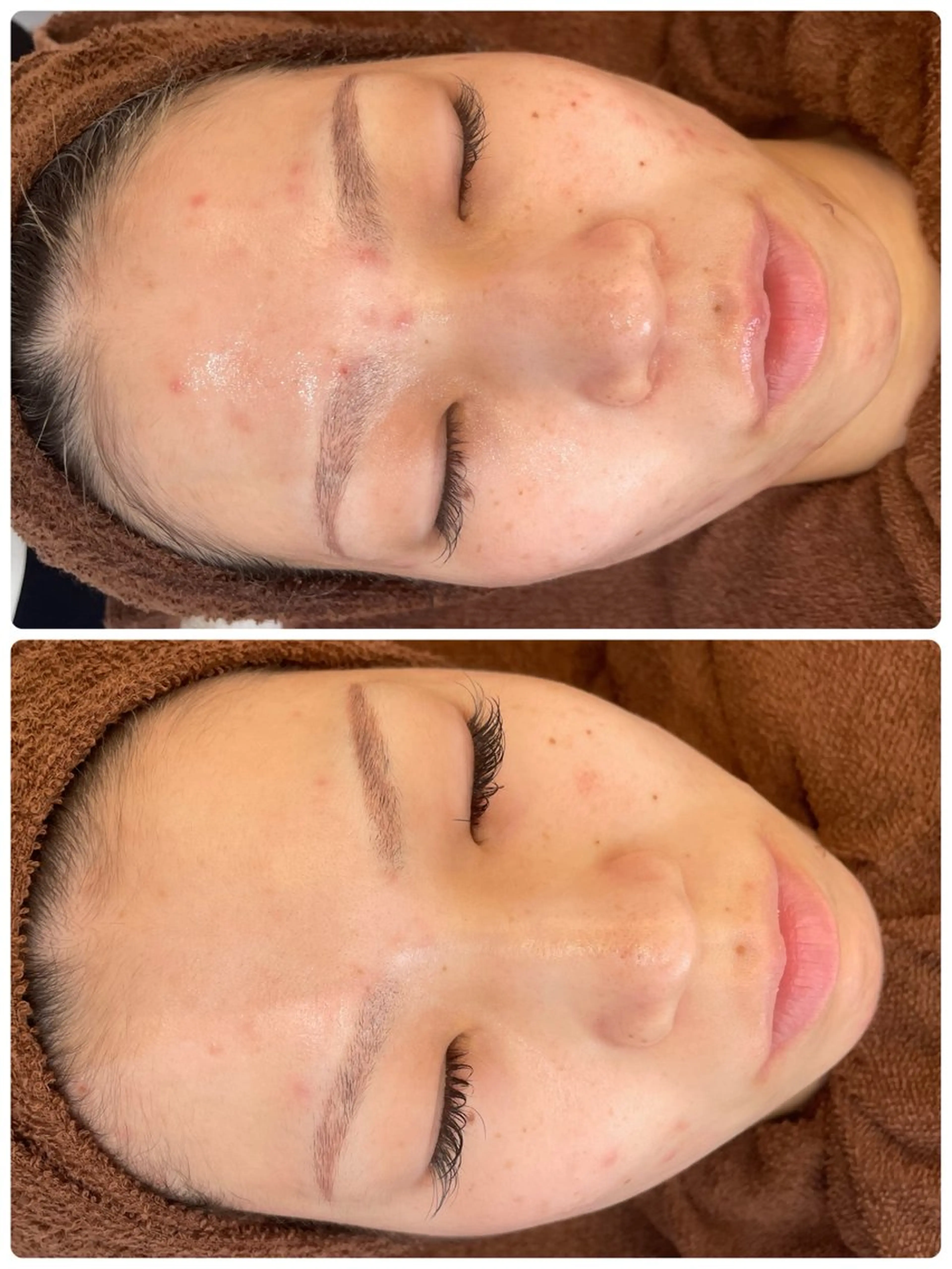 エステ リラク パーソナルスキンケア 🦋APRI🅿️有のエステ・リラクイメージ