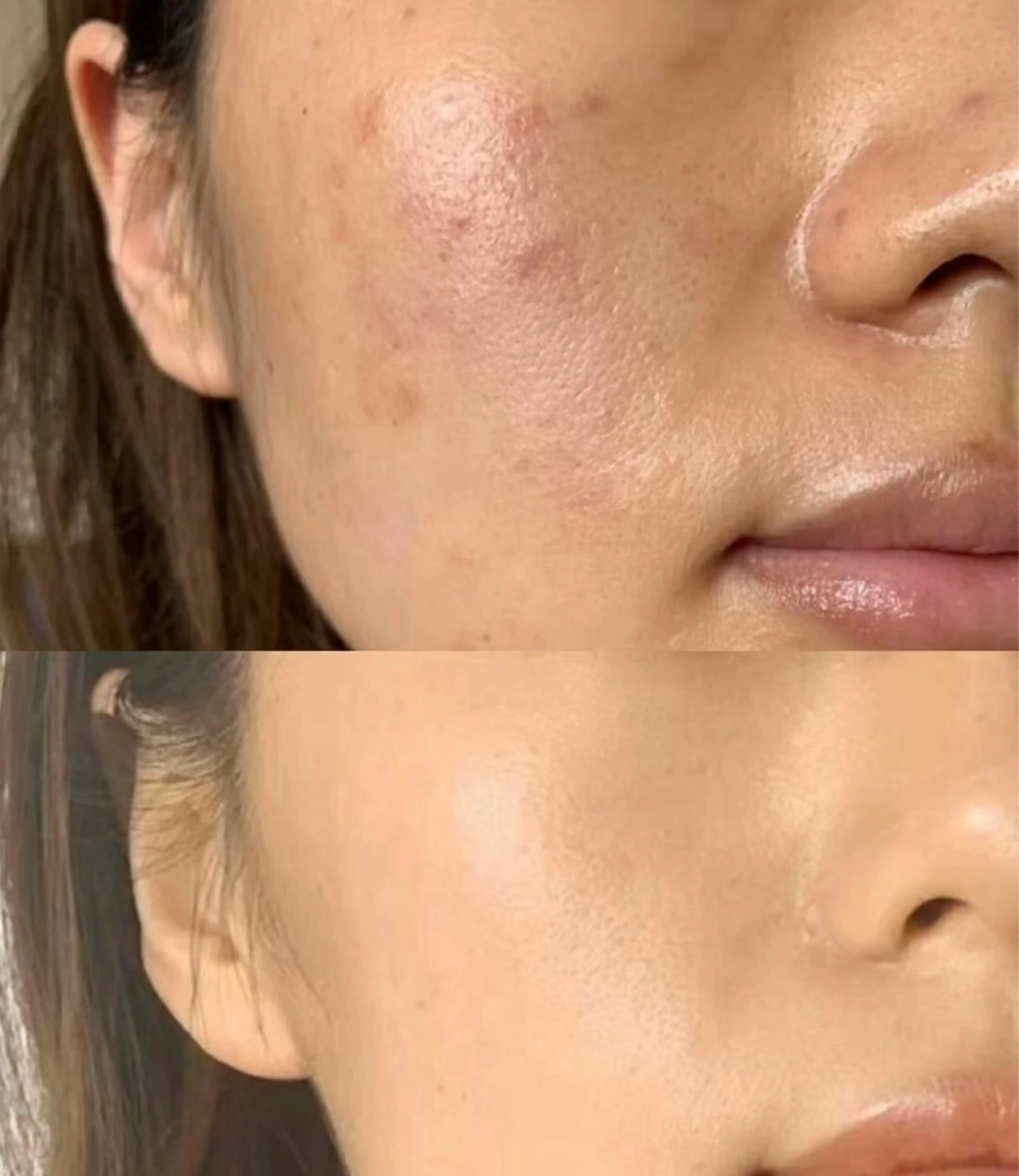 ネイル エステ aliaハーブ水光店 エステティシャン募集のエステ・リラクイメージ