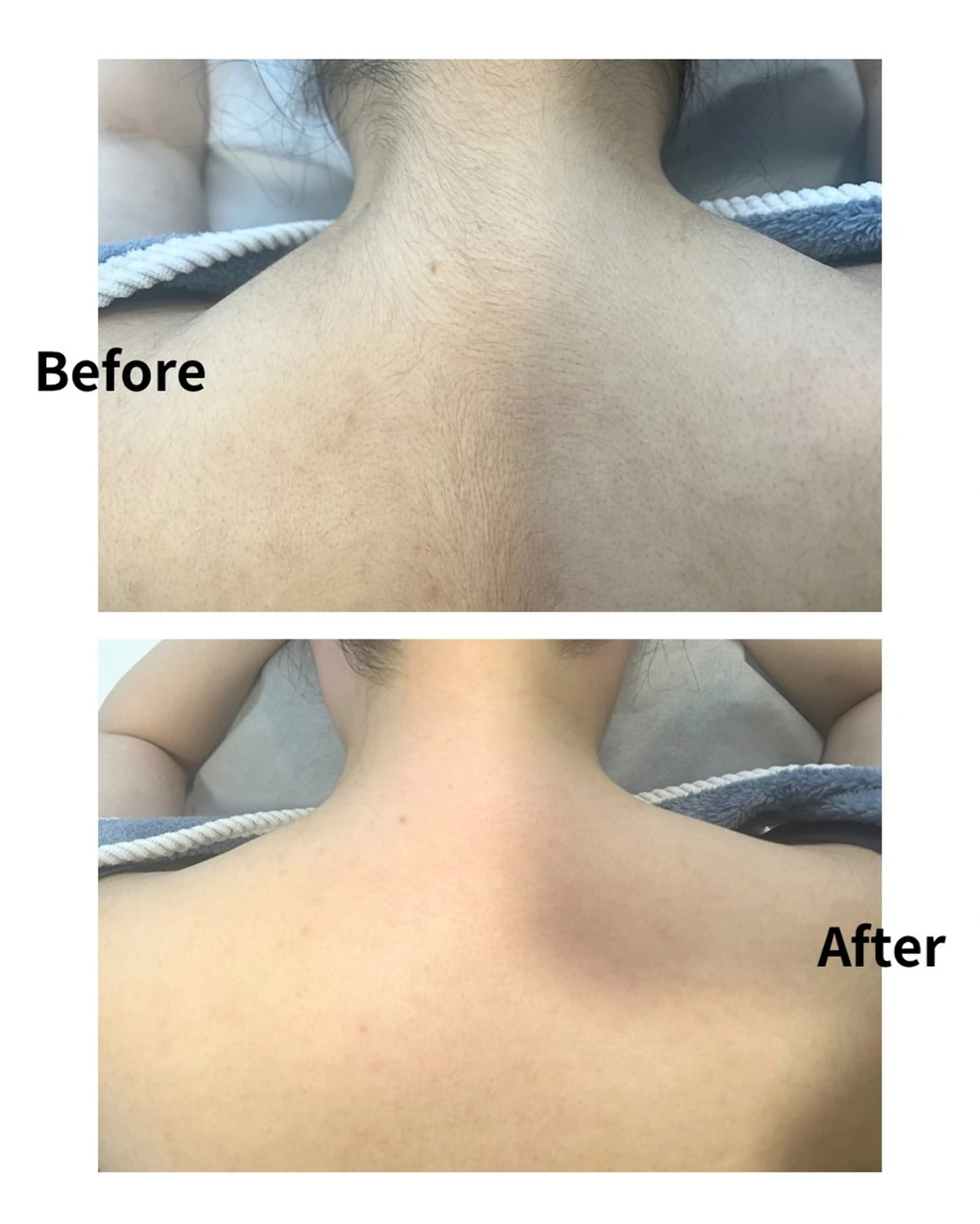 脱毛 MASAMI マサミのエステ・リラクイメージ