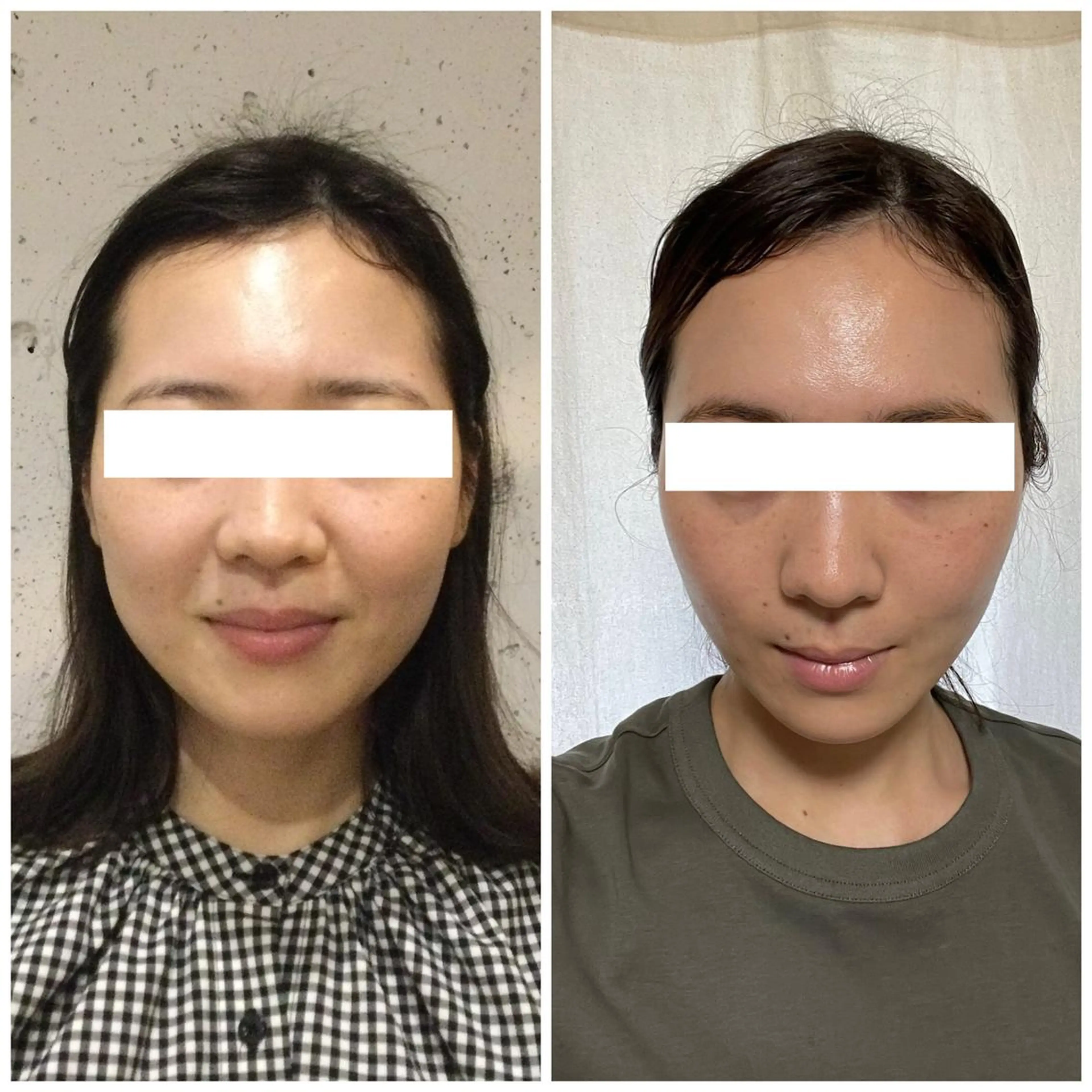 最強小顔60分(お着替え＋カウンセリング含)の写真