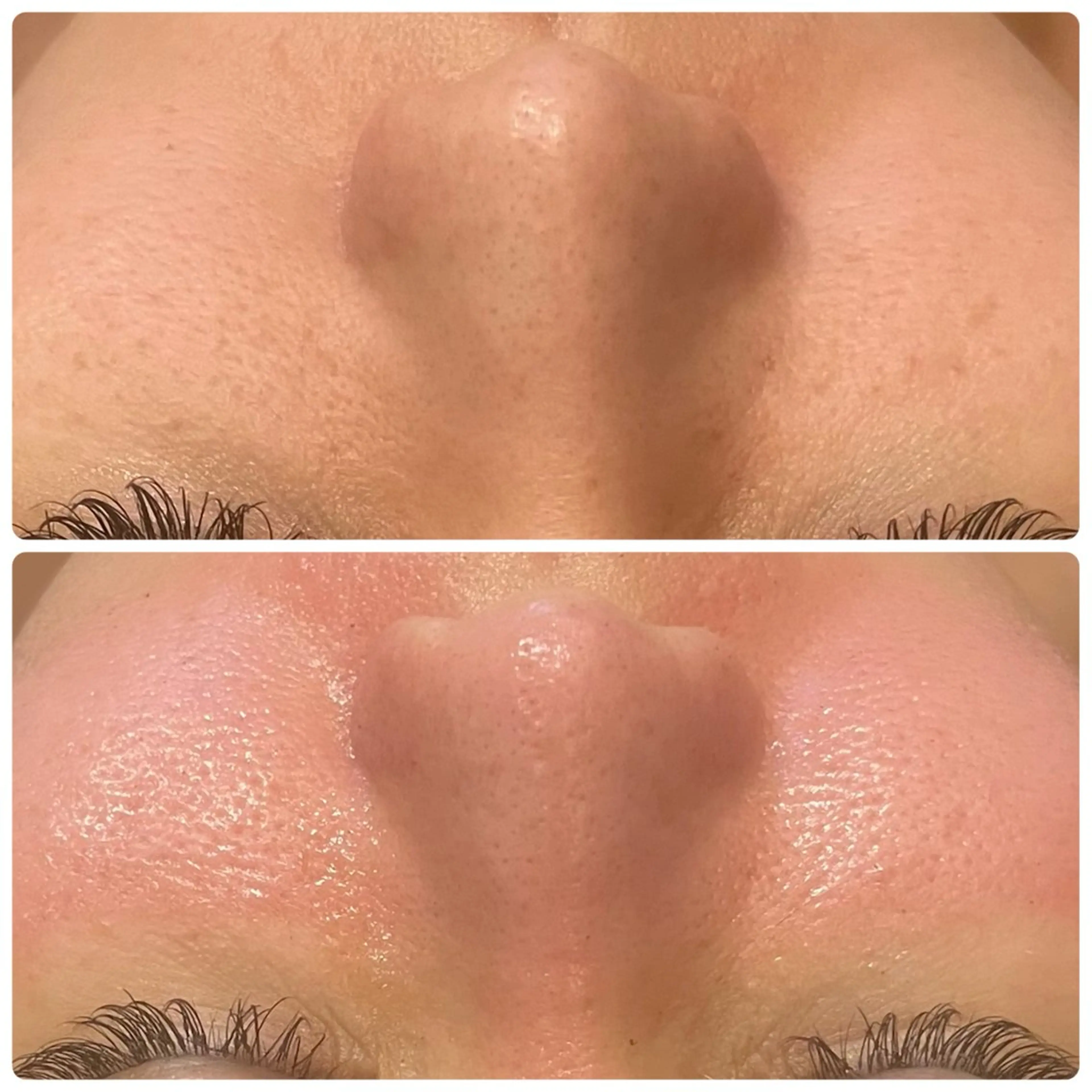 yellow💛【 脱毛&フェイシャル】のエステ・リラクイメージ