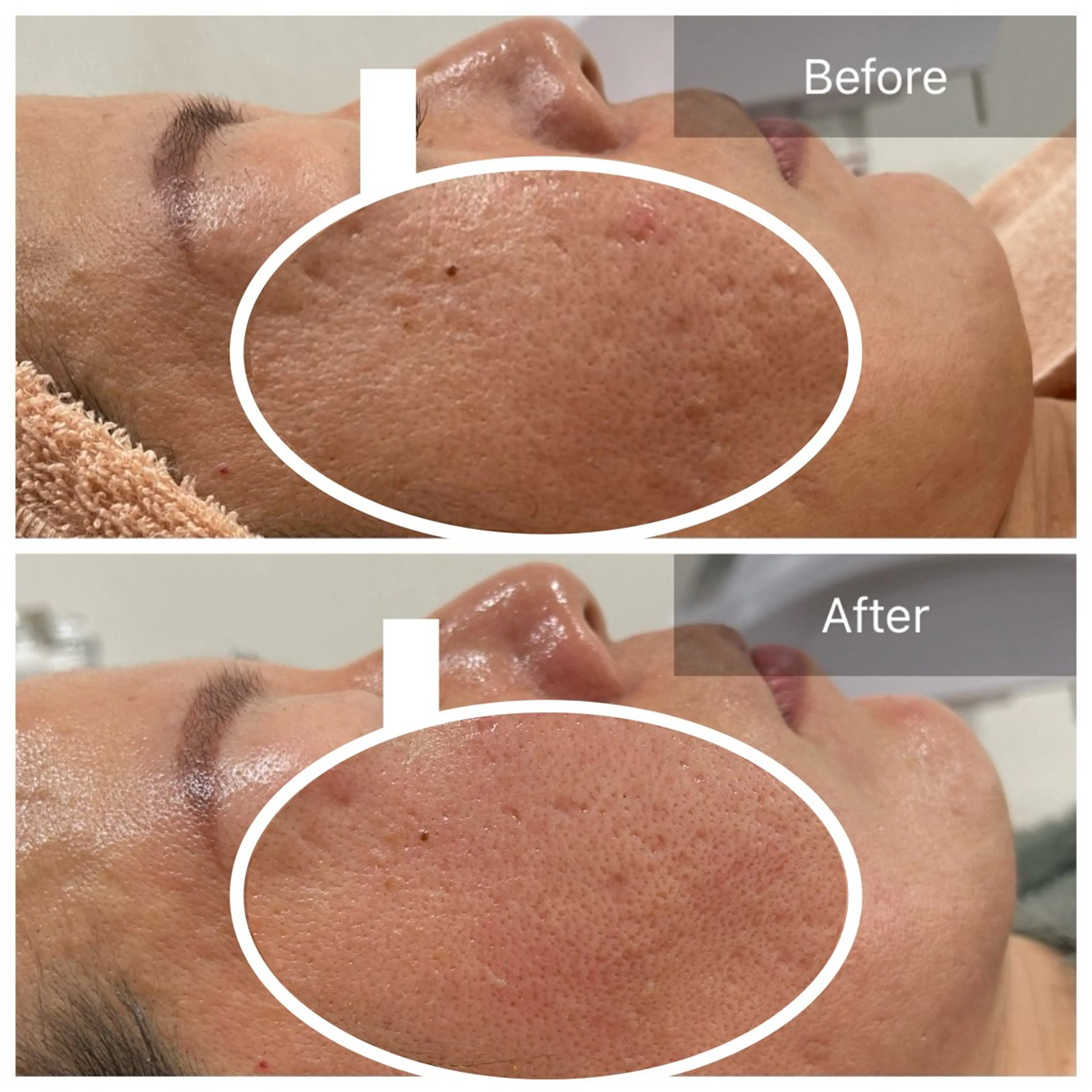 エステ 【現役看護師】高来 笑子のエステ・リラクイメージ