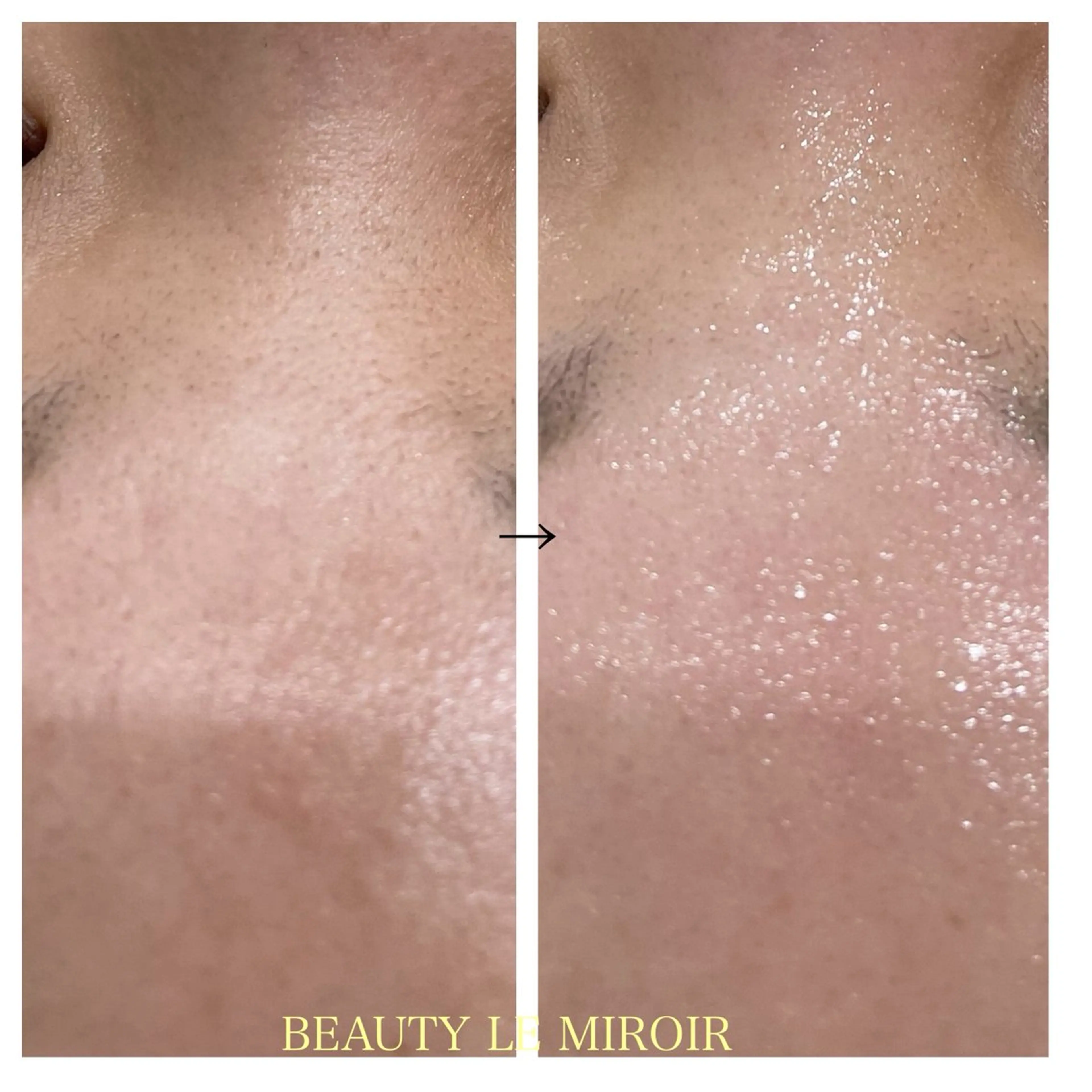 ビューティー ミロワールのエステ・リラクイメージ