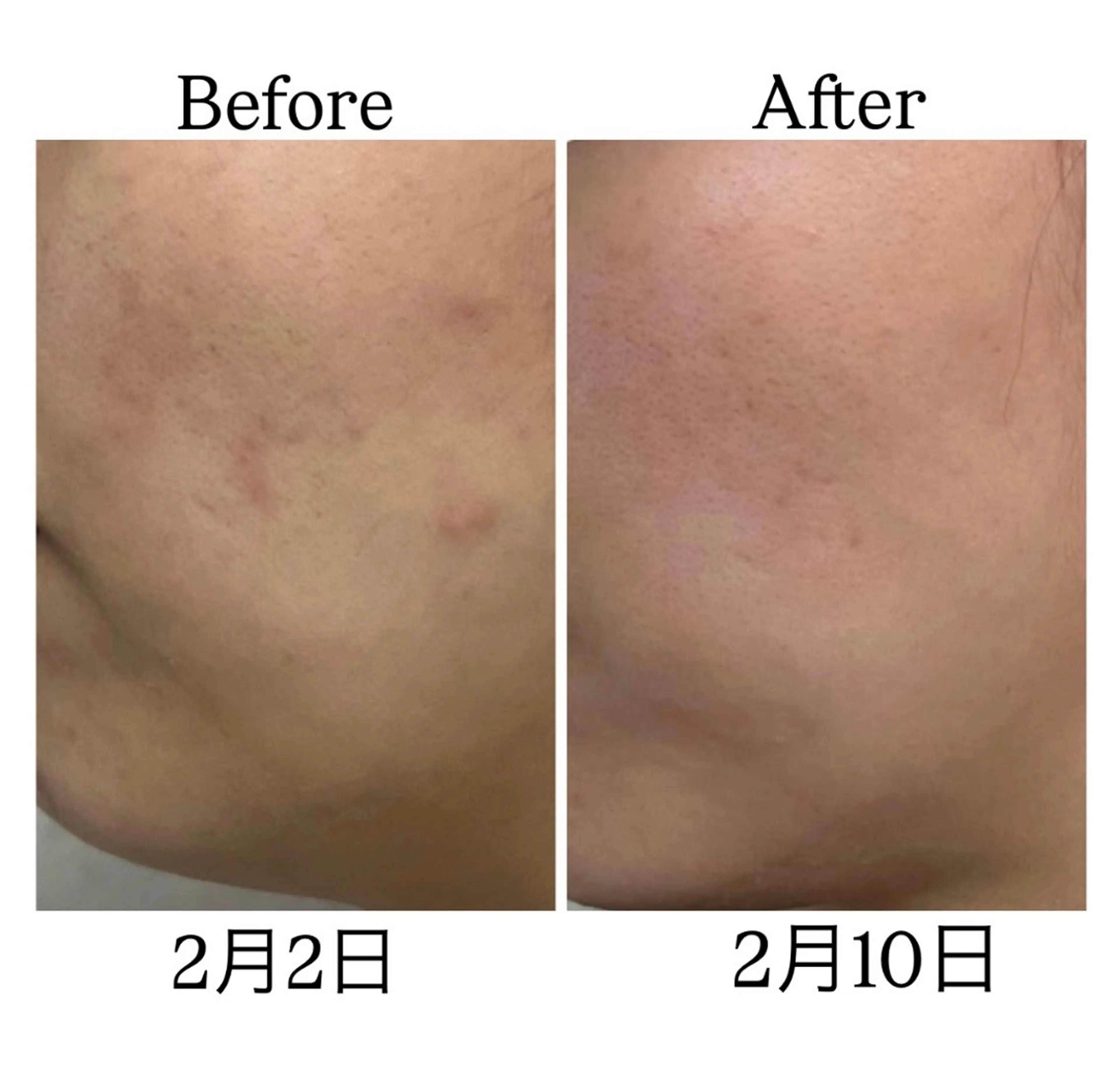 エステ ROR Akariのエステ・リラクイメージ