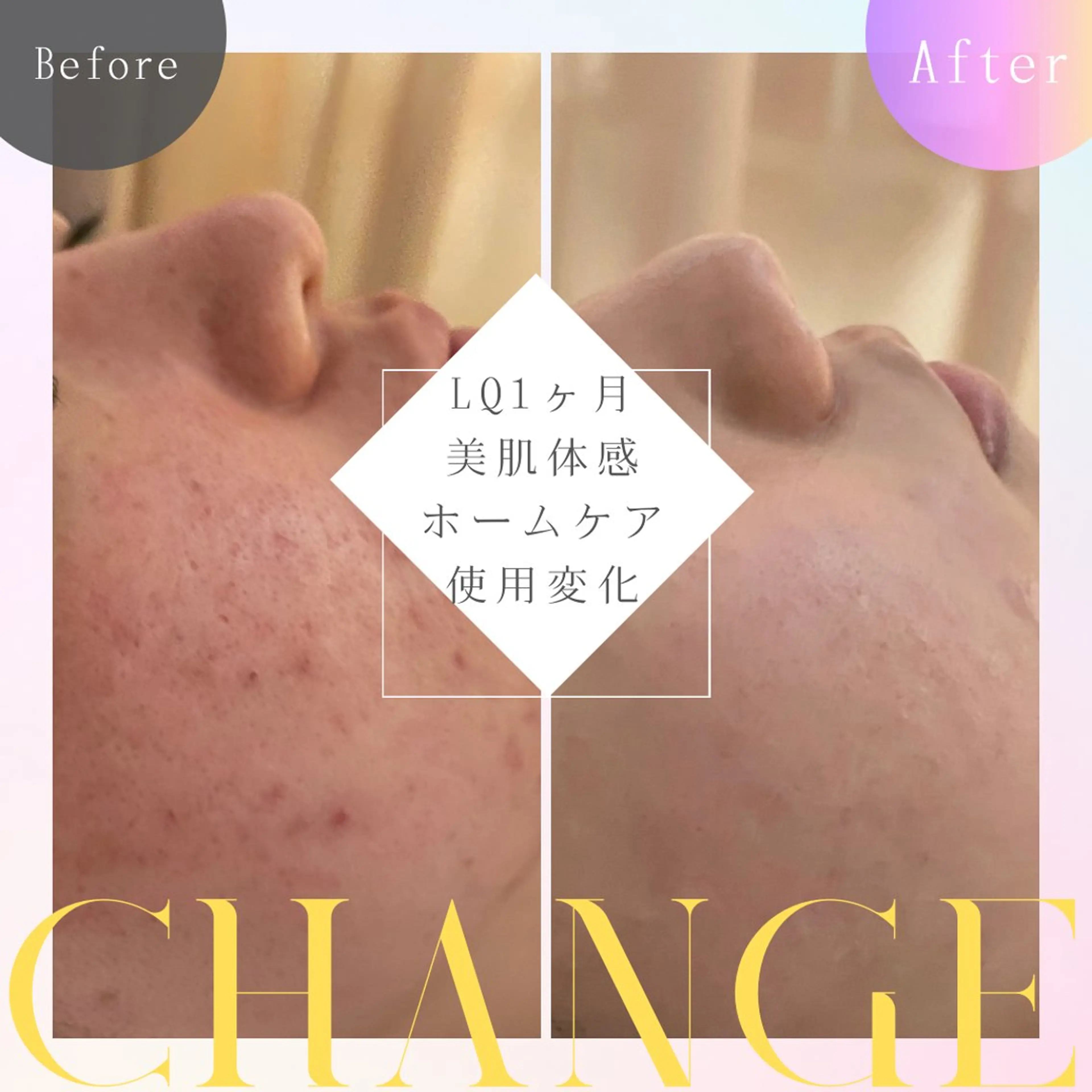 すっぴんに自信、取り戻そう🪞💓 🎐透明感UPモニター募集中！の写真