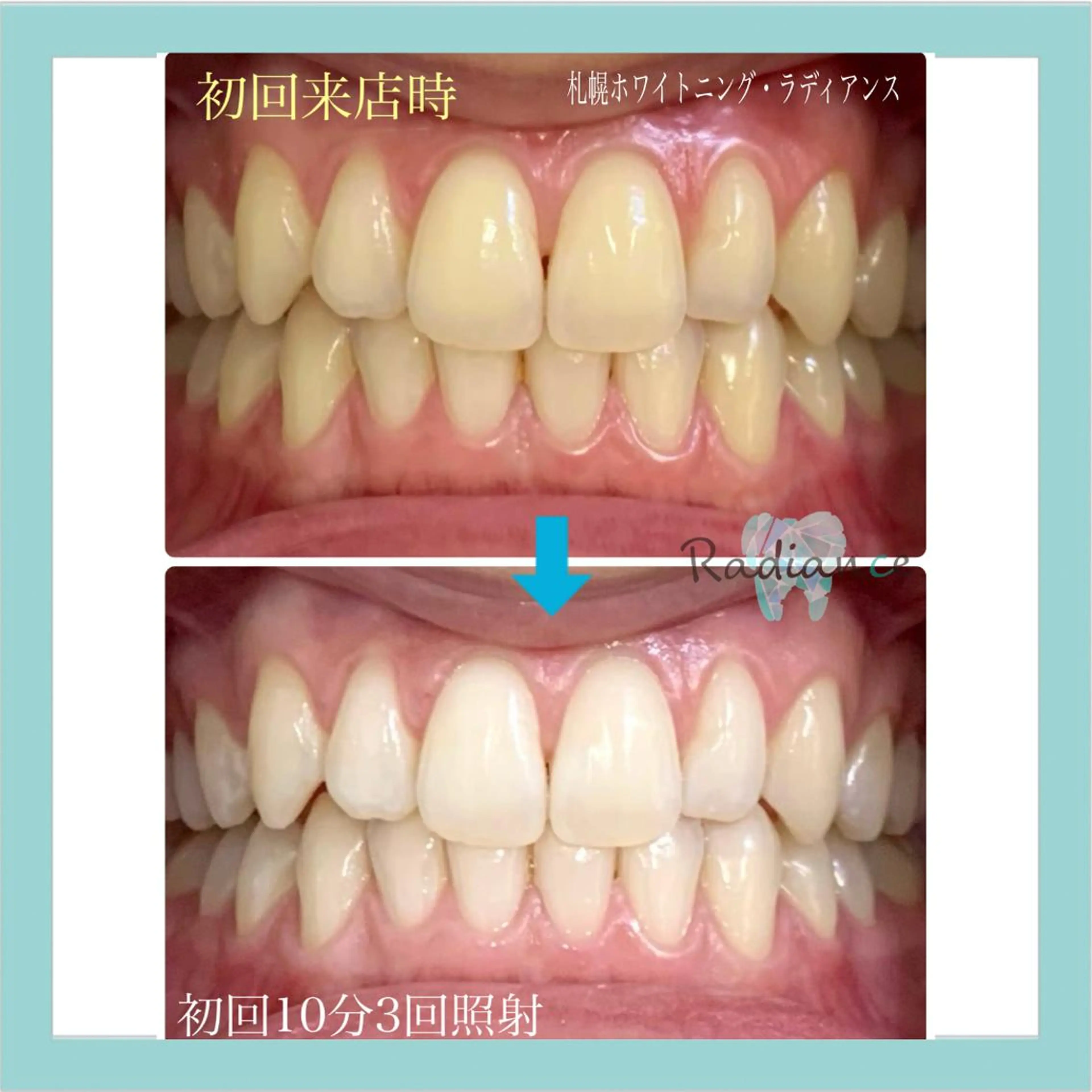 その他 札幌ホワイトニング ラディアンス札幌駅店のその他イメージ