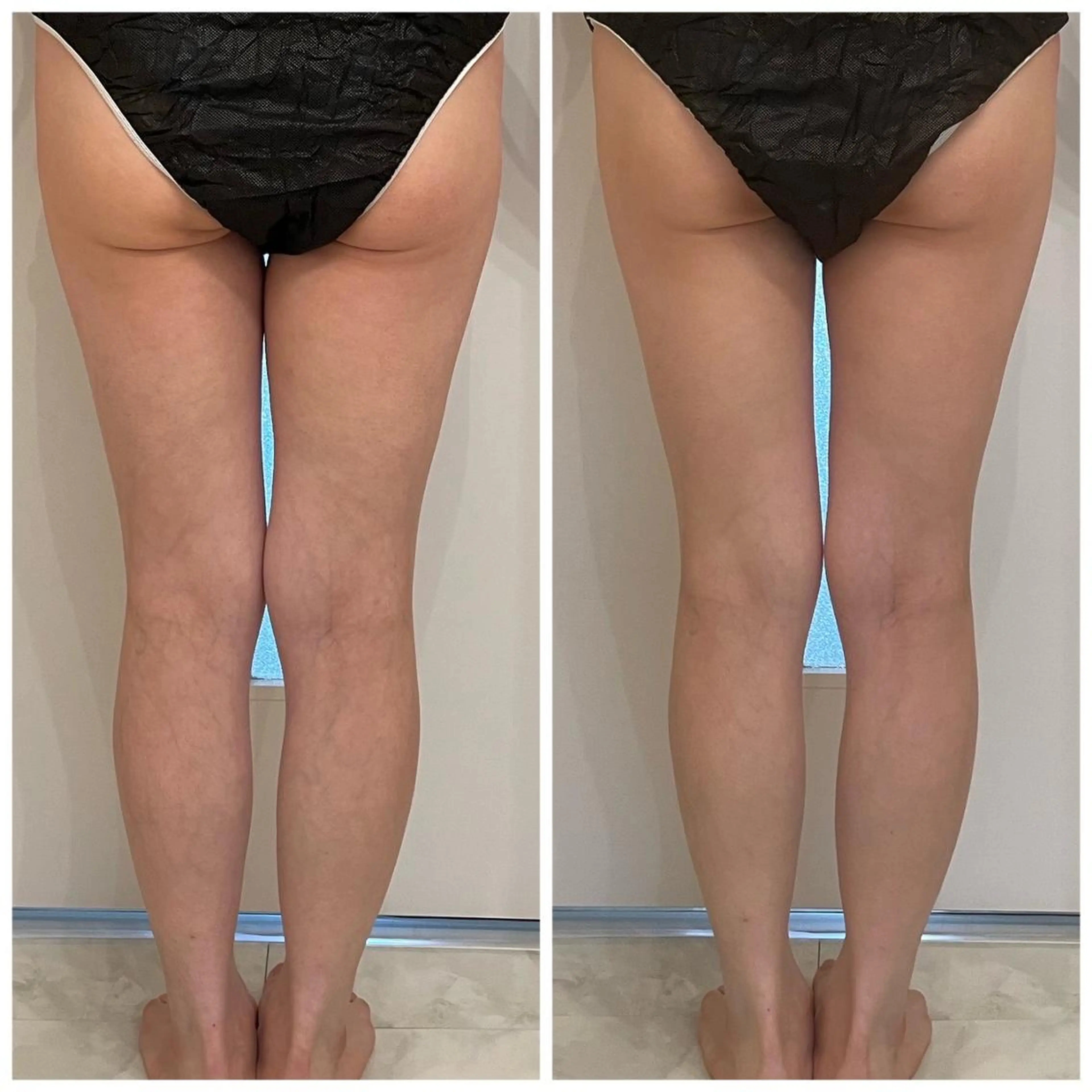 ララ/ハーブ メゾンリュバンのエステ・リラクイメージ