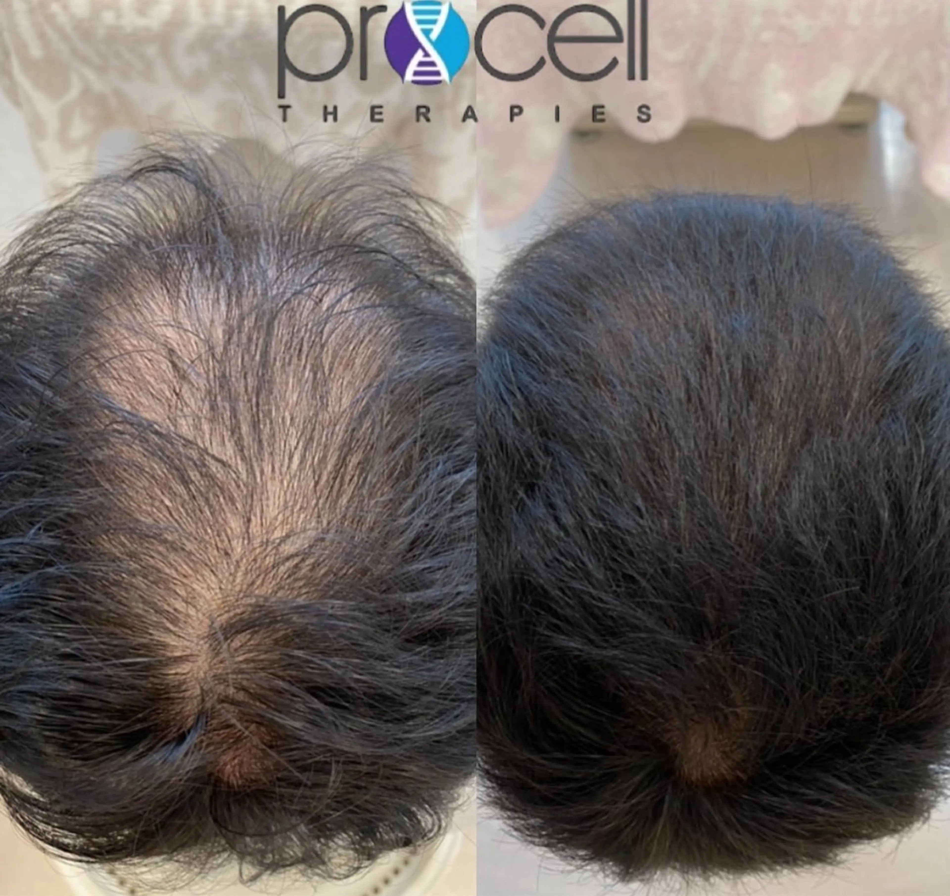 メンズ Blooming所属・LOUISE. ／肌質・頭皮のエステ・リラクイメージ