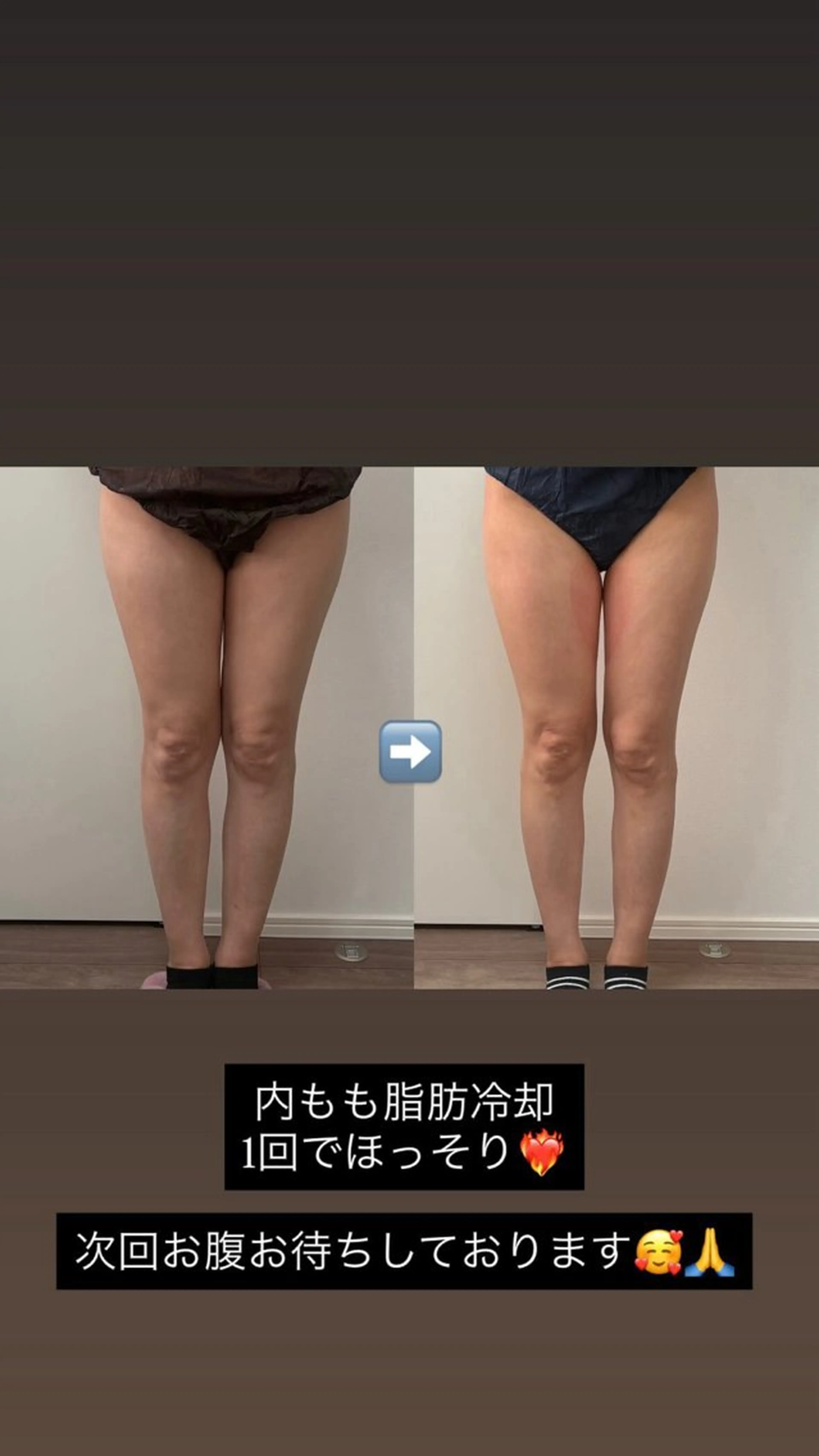 エステ 石巻 冷却痩身 Miiju. 鈴木のエステ・リラクイメージ