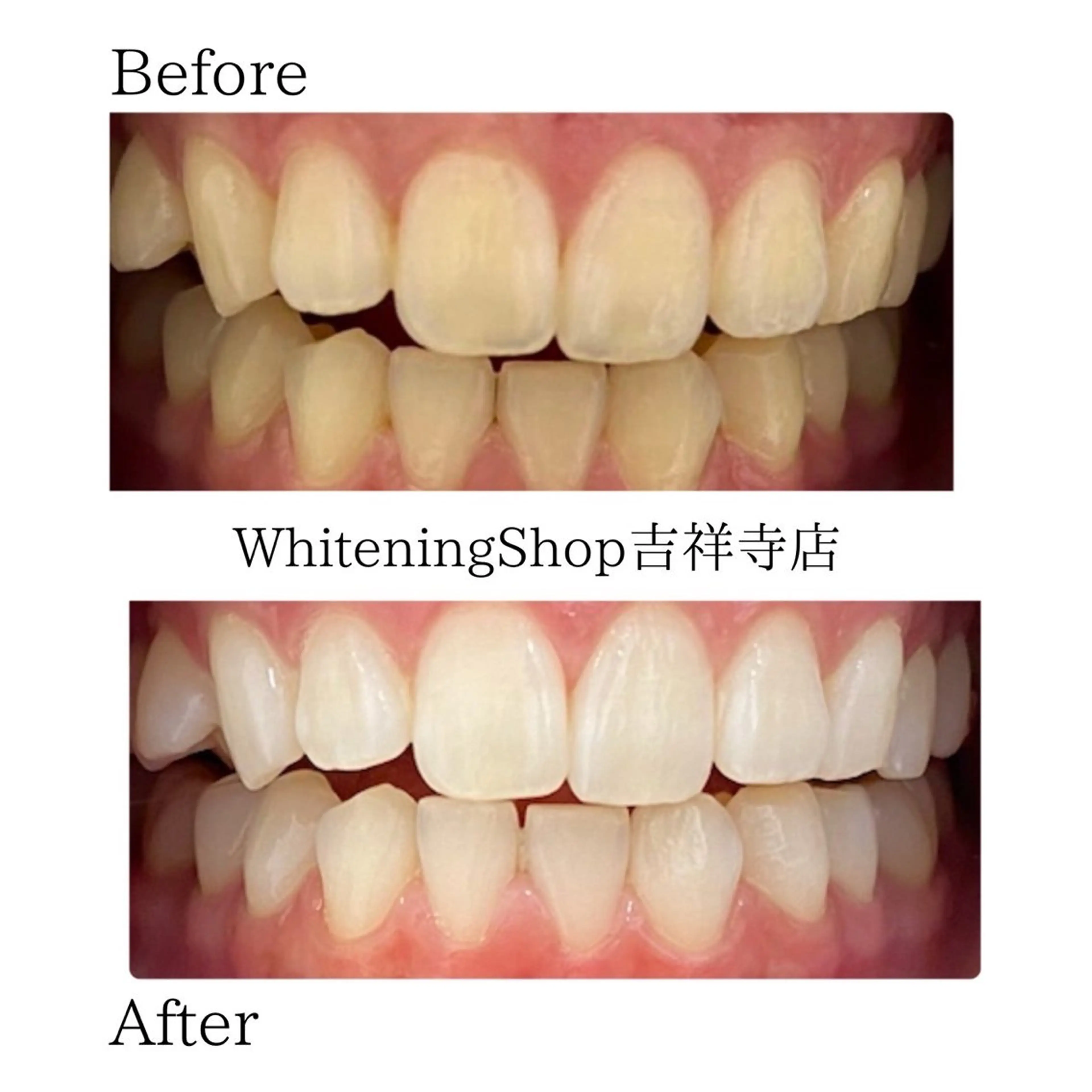 エステ リラク ホワイトニング ショップ吉祥寺店のエステ・リラクイメージ