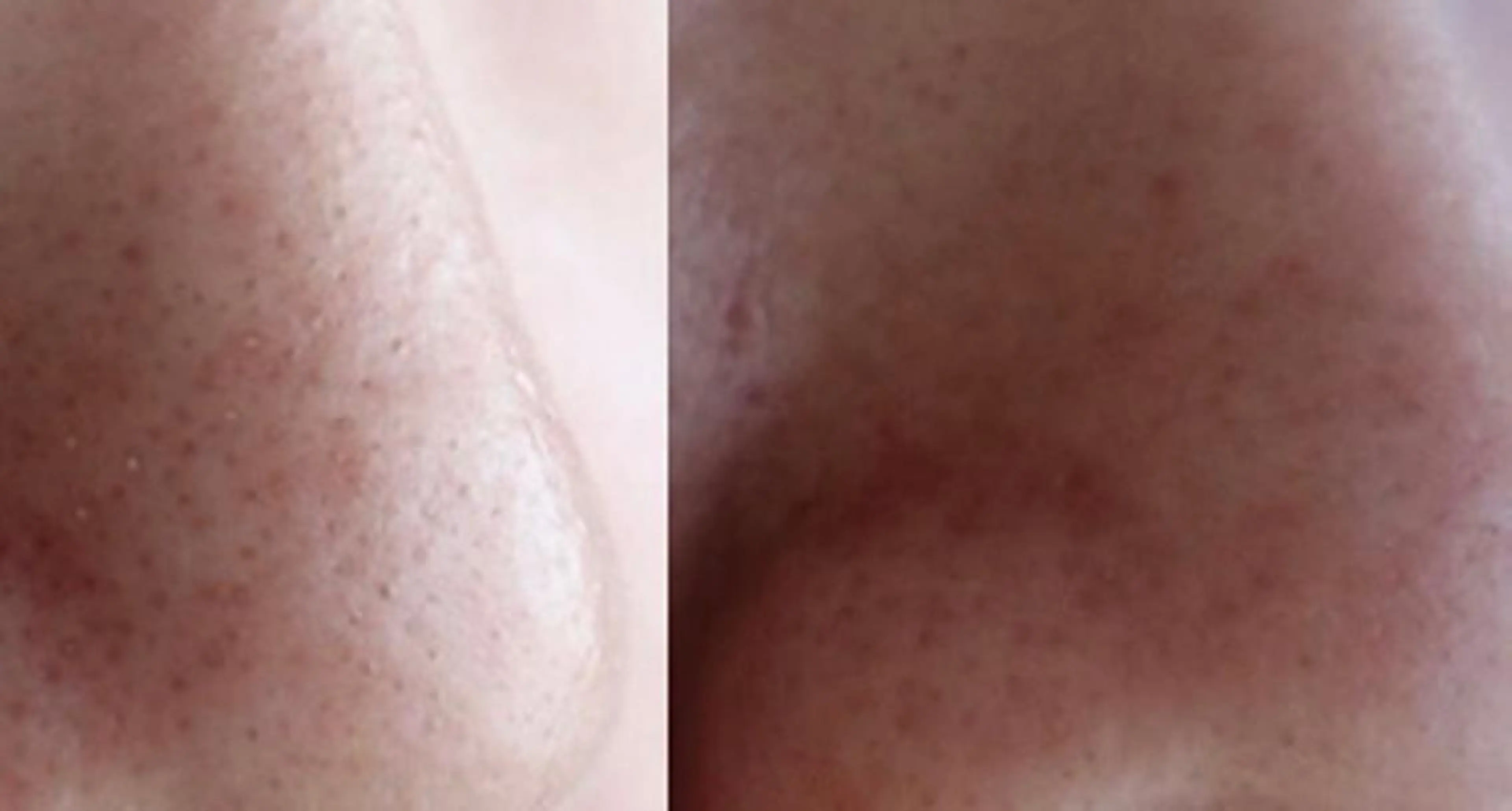 朝重い人専用 肩甲骨調整のエステ・リラクイメージ