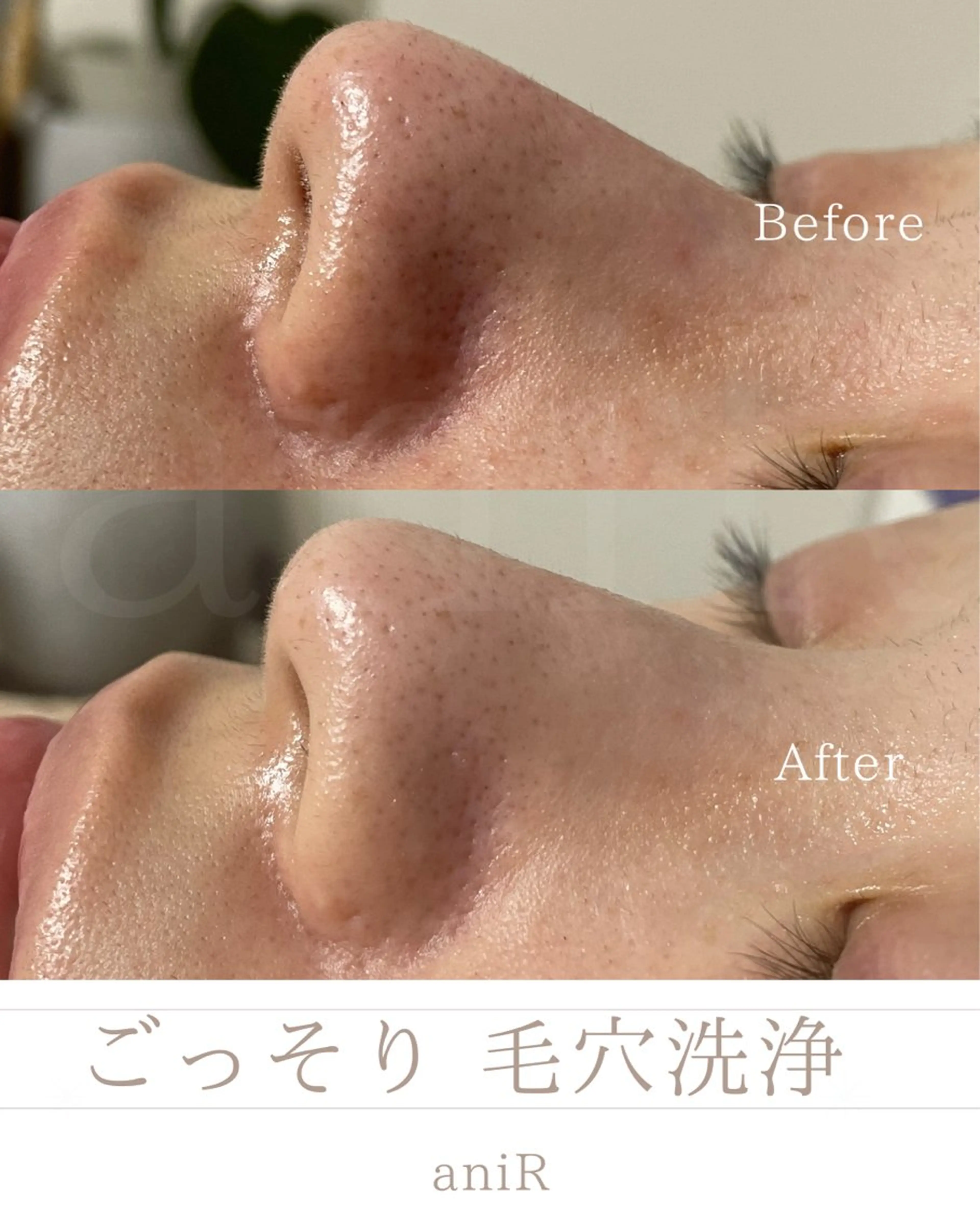 北浜/毛穴洗浄ツヤ肌 サロンaniRのエステ・リラクイメージ