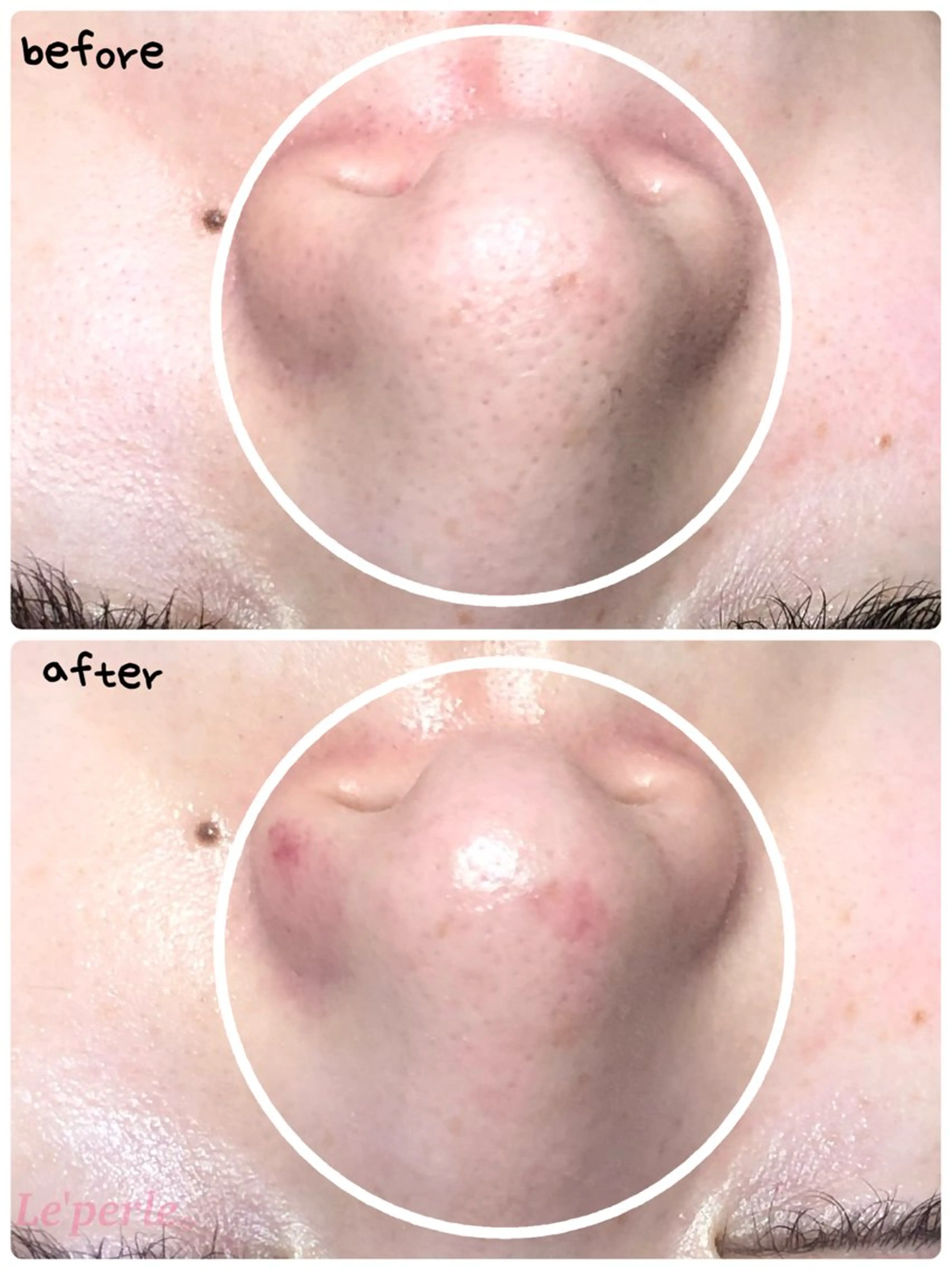 エステ Le'perle｡所属・Le'perle｡ Kyokaのエステ・リラクイメージ