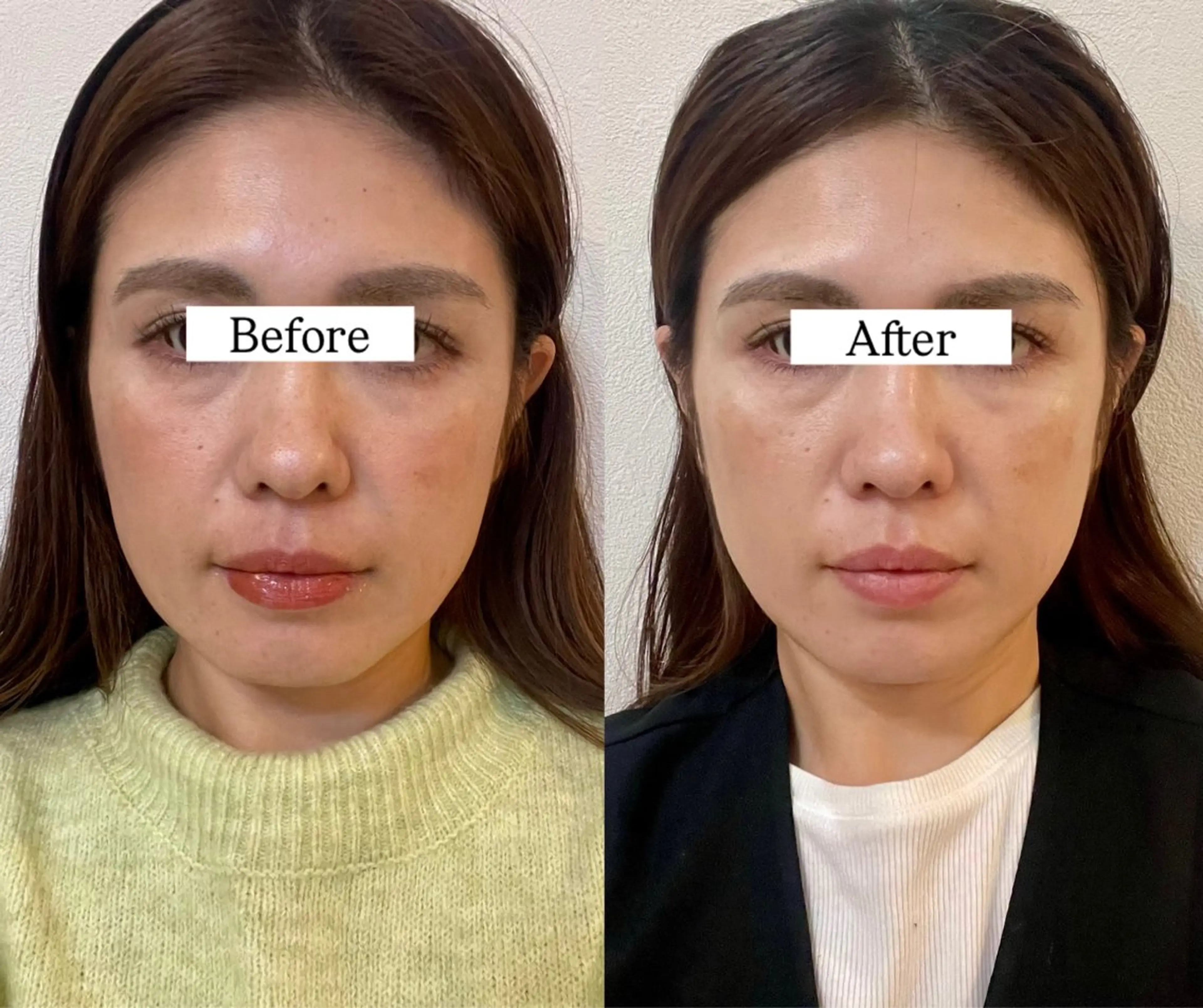 エステ リラク Private SalonOboraのエステ・リラクイメージ