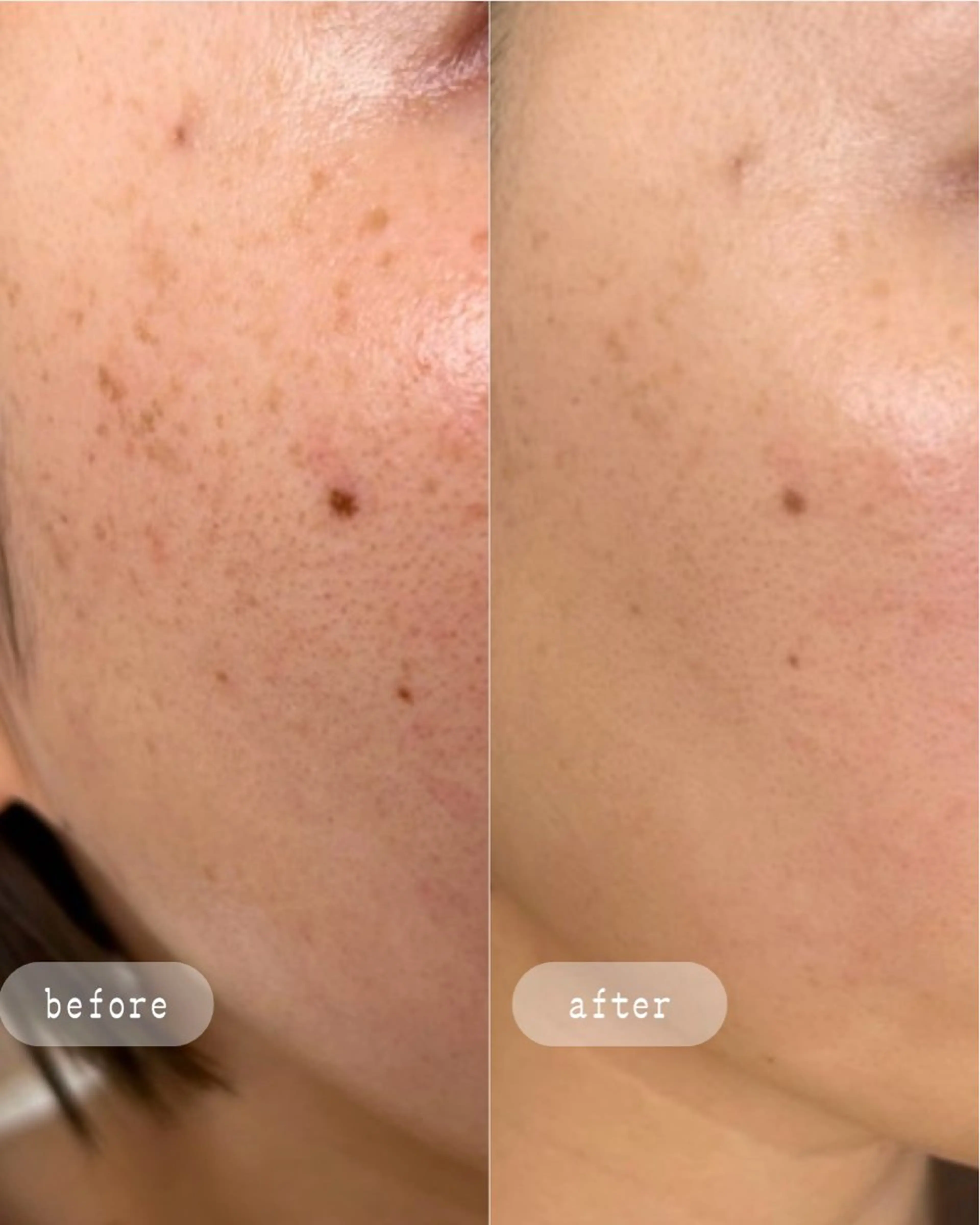 エステ LaVibe ann.のエステ・リラクイメージ