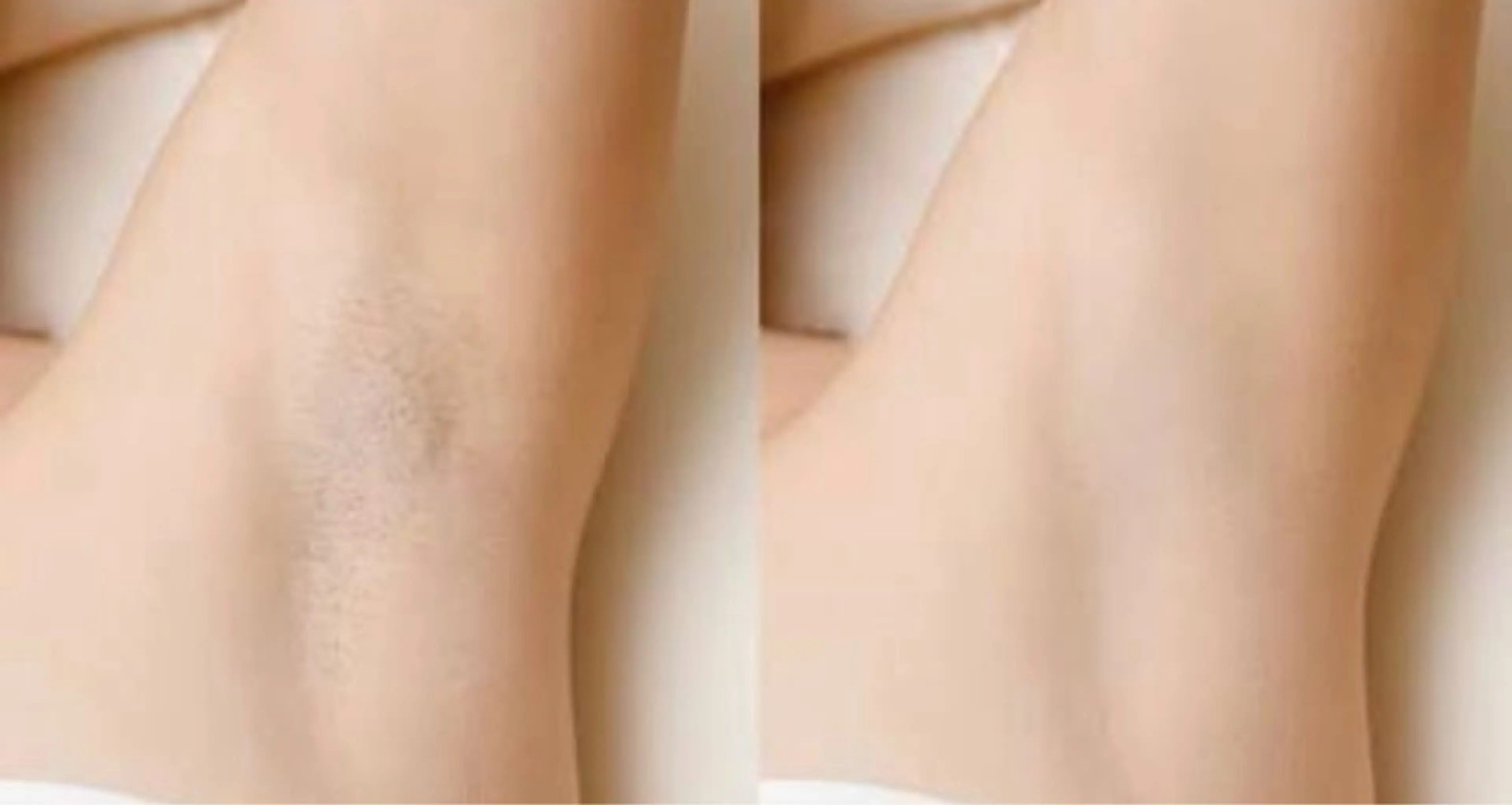 エステ Lala Beautyのエステ・リラクイメージ