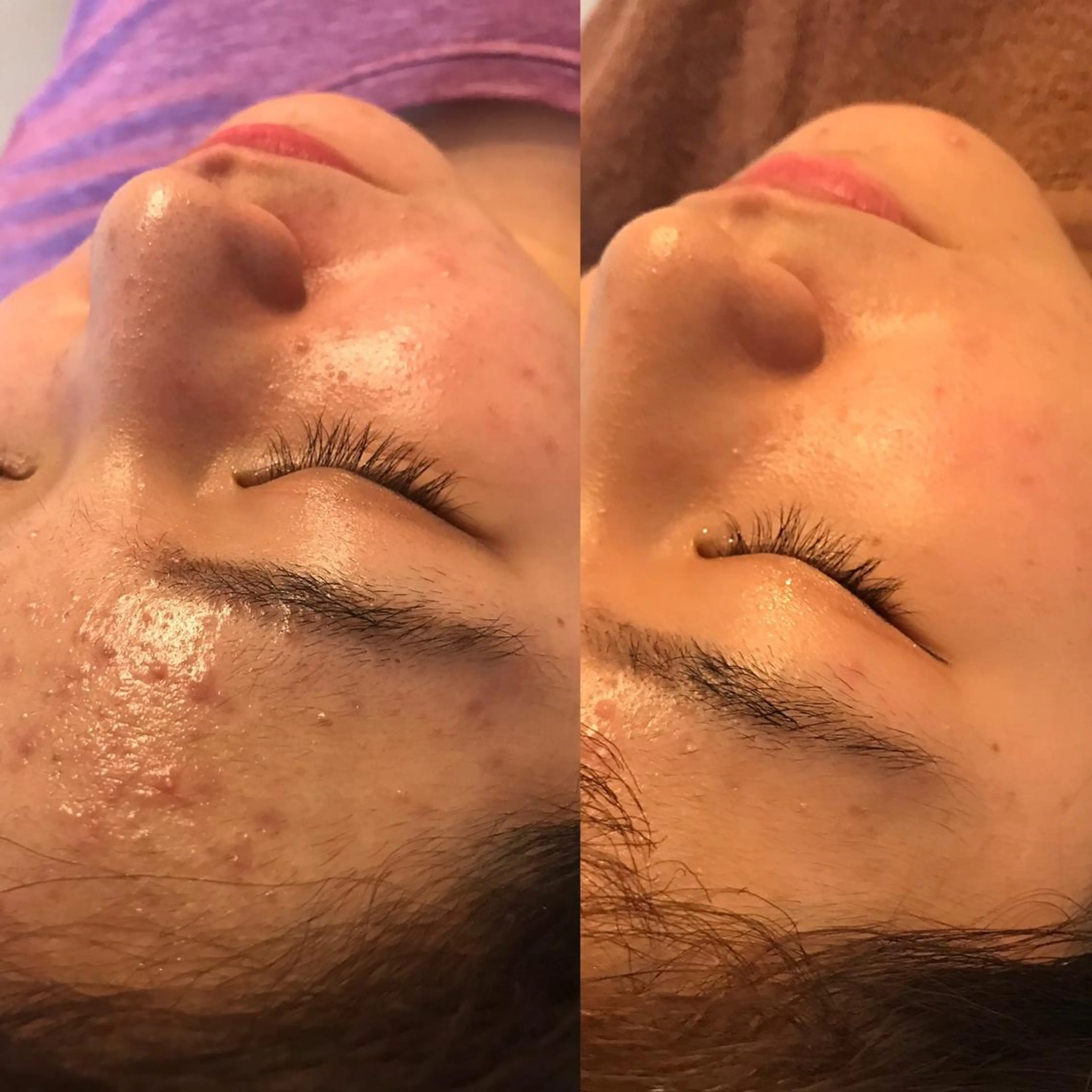 はりすたいる 鍼灸院のエステ・リラクイメージ