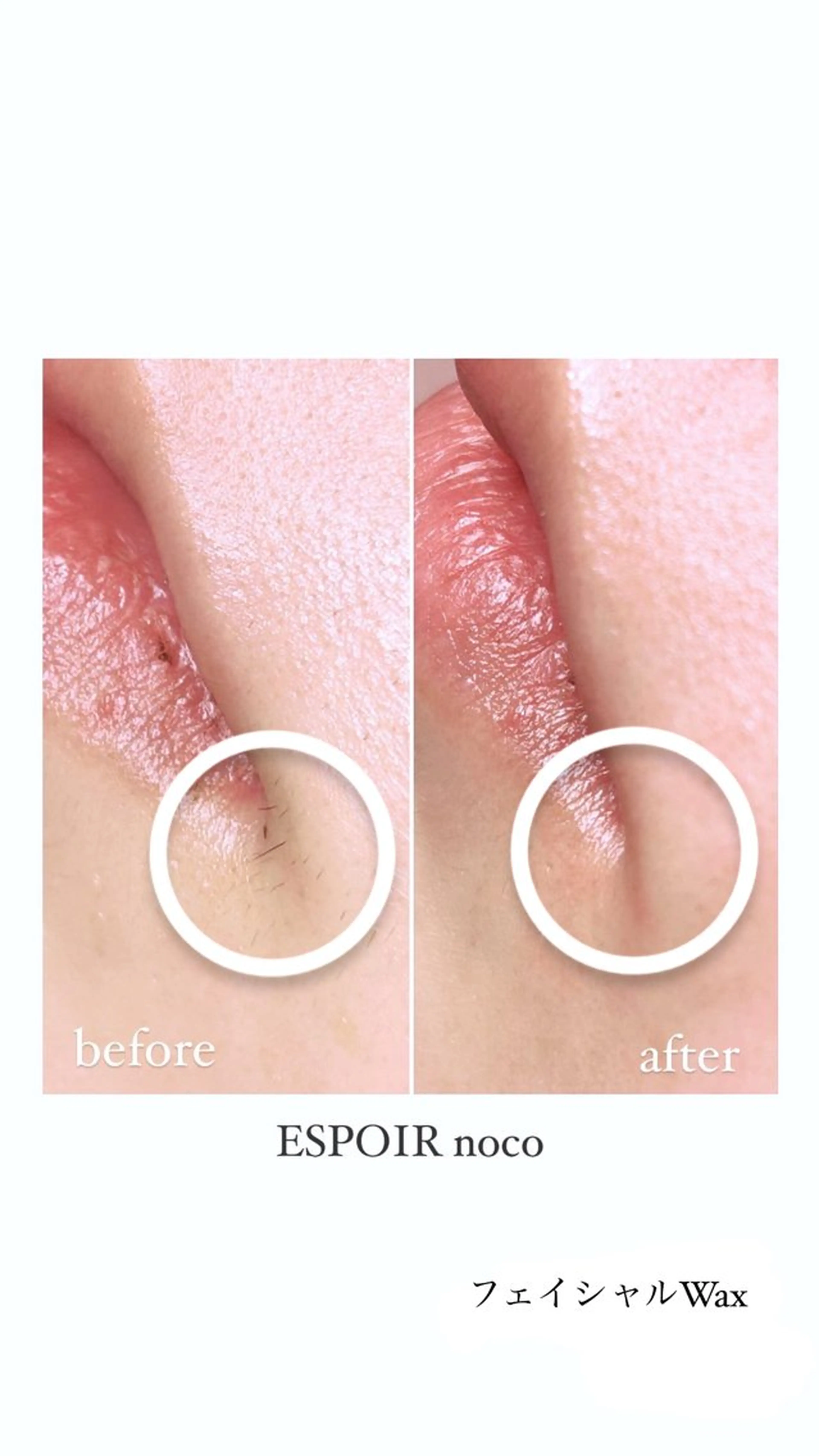 ワックス脱毛🌈 ESPOIRnocoのエステ・リラクイメージ