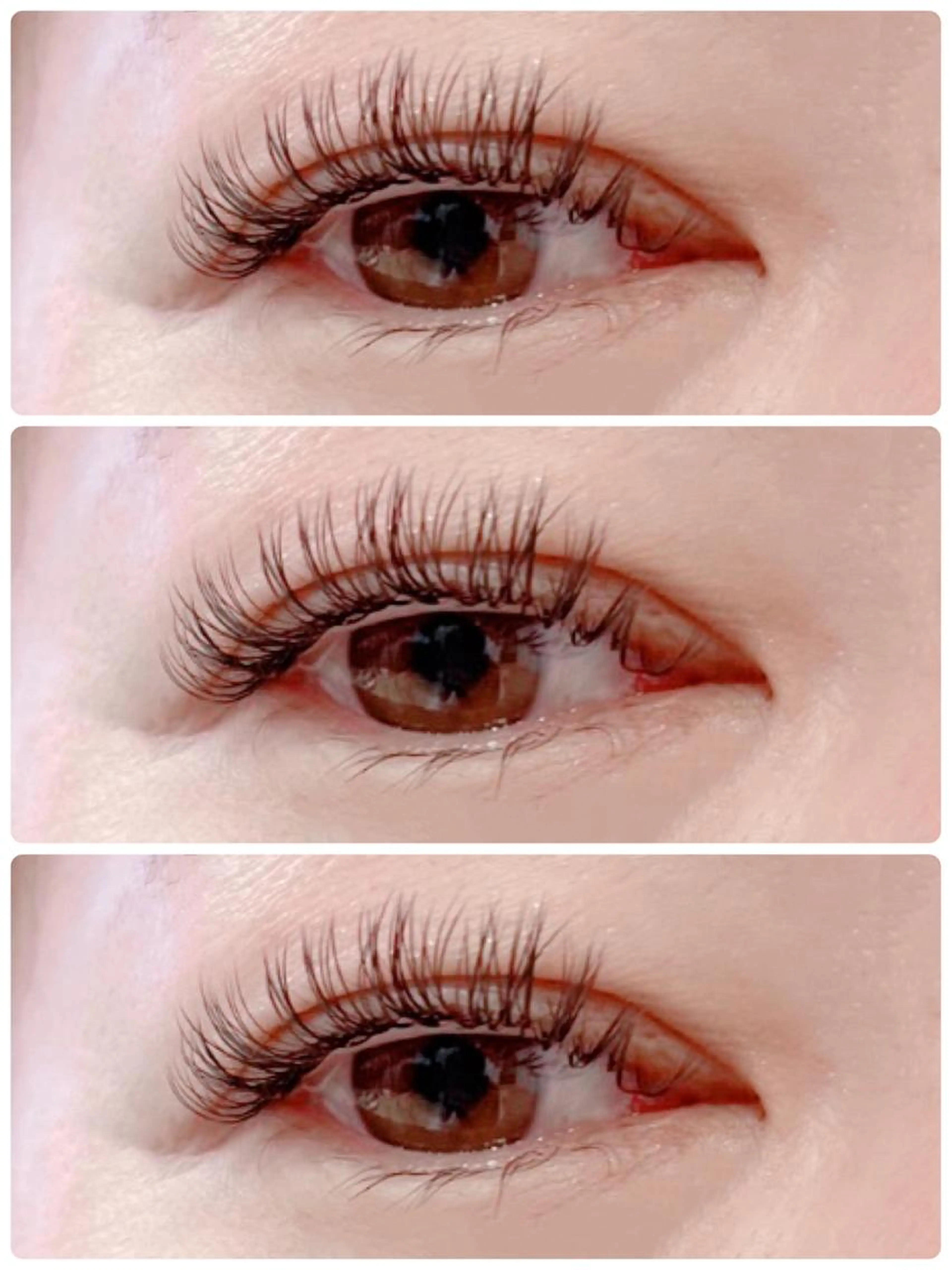 リフトアップ➕ダブルフラット200本までの写真