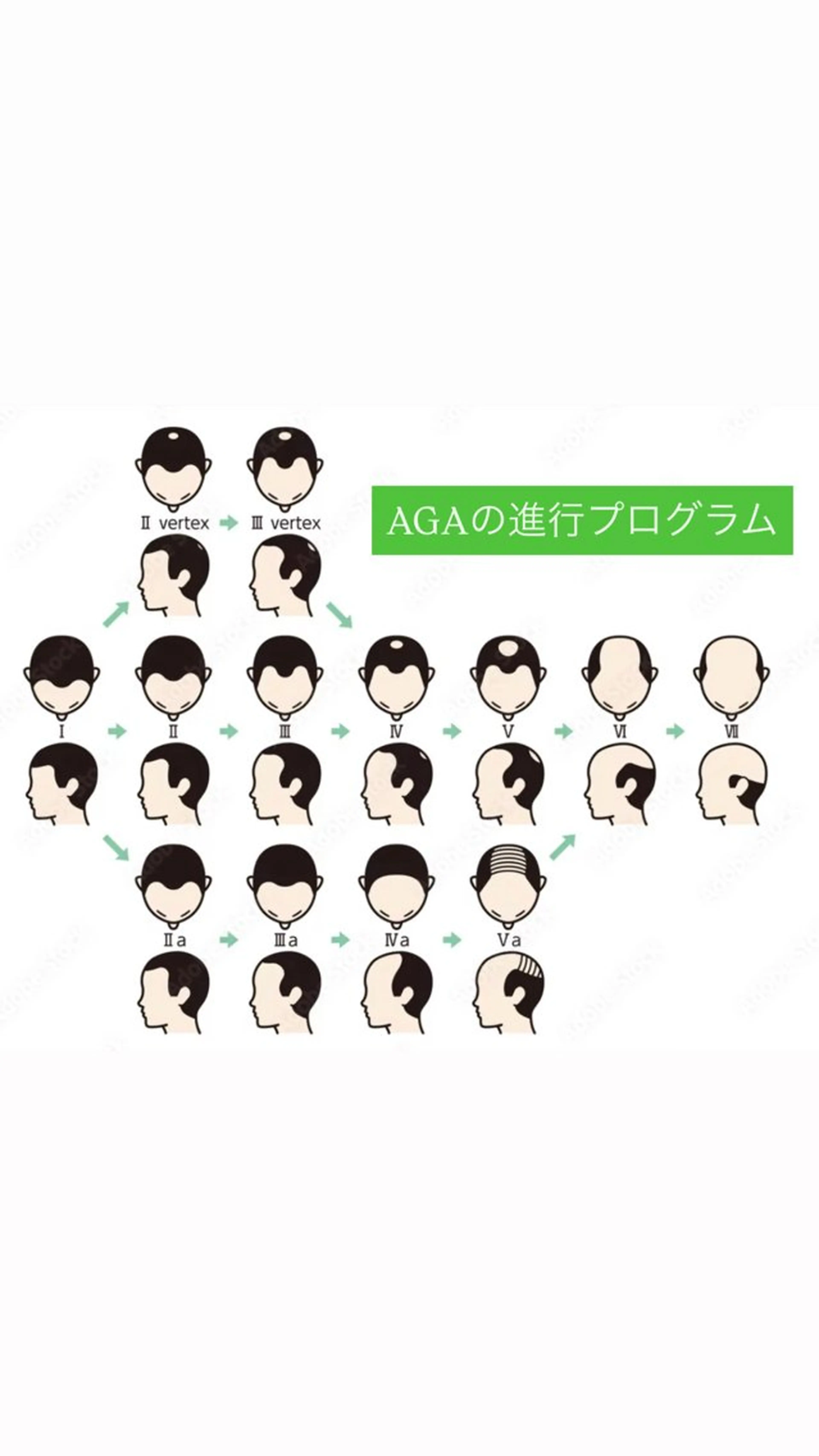 メンズ 美肌脱毛エステサロン Luangeのエステ・リラクイメージ