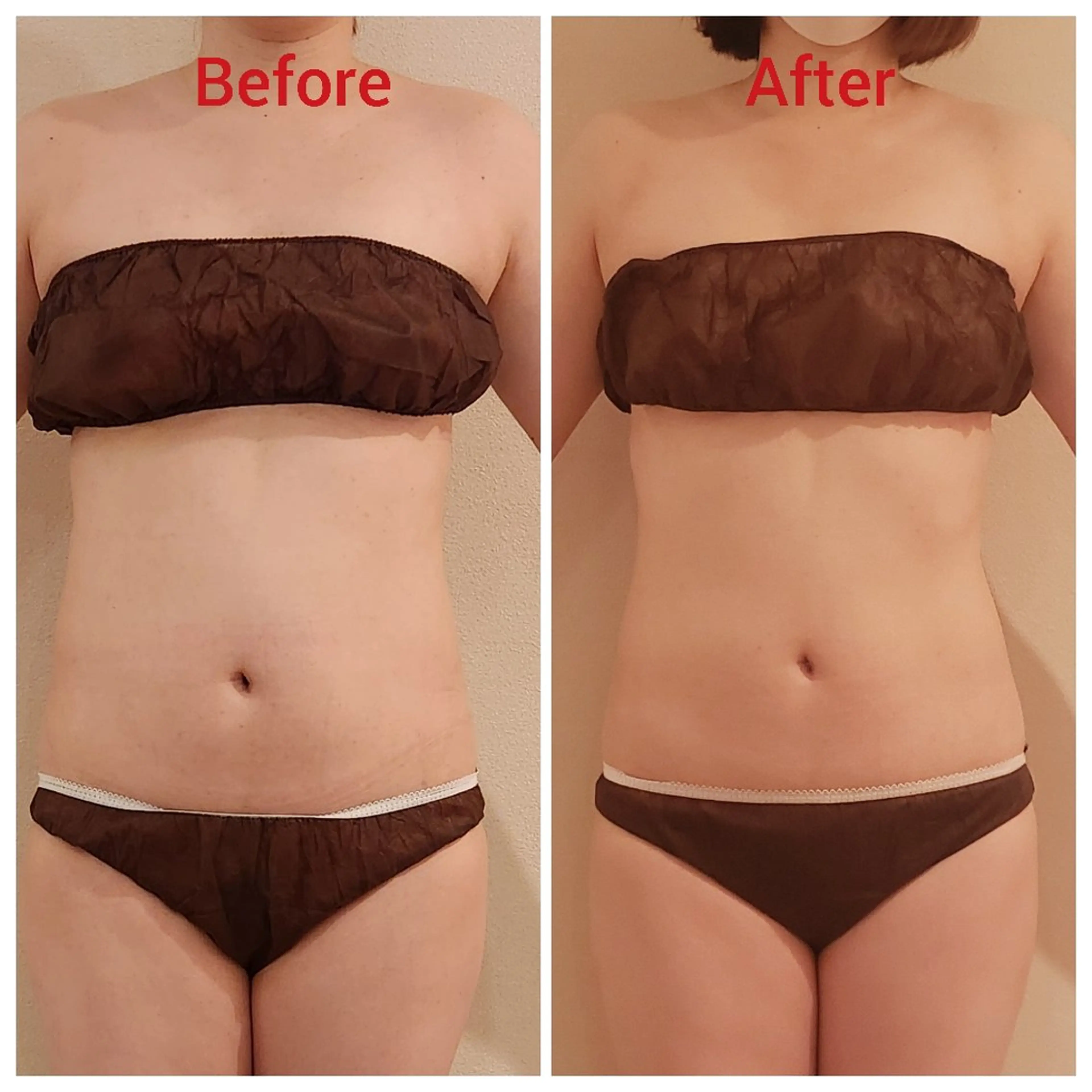 くびれ集中！浮き輪肉へアプローチ！話題の痩身マシーンでお腹&腰を徹底ケア☆の写真