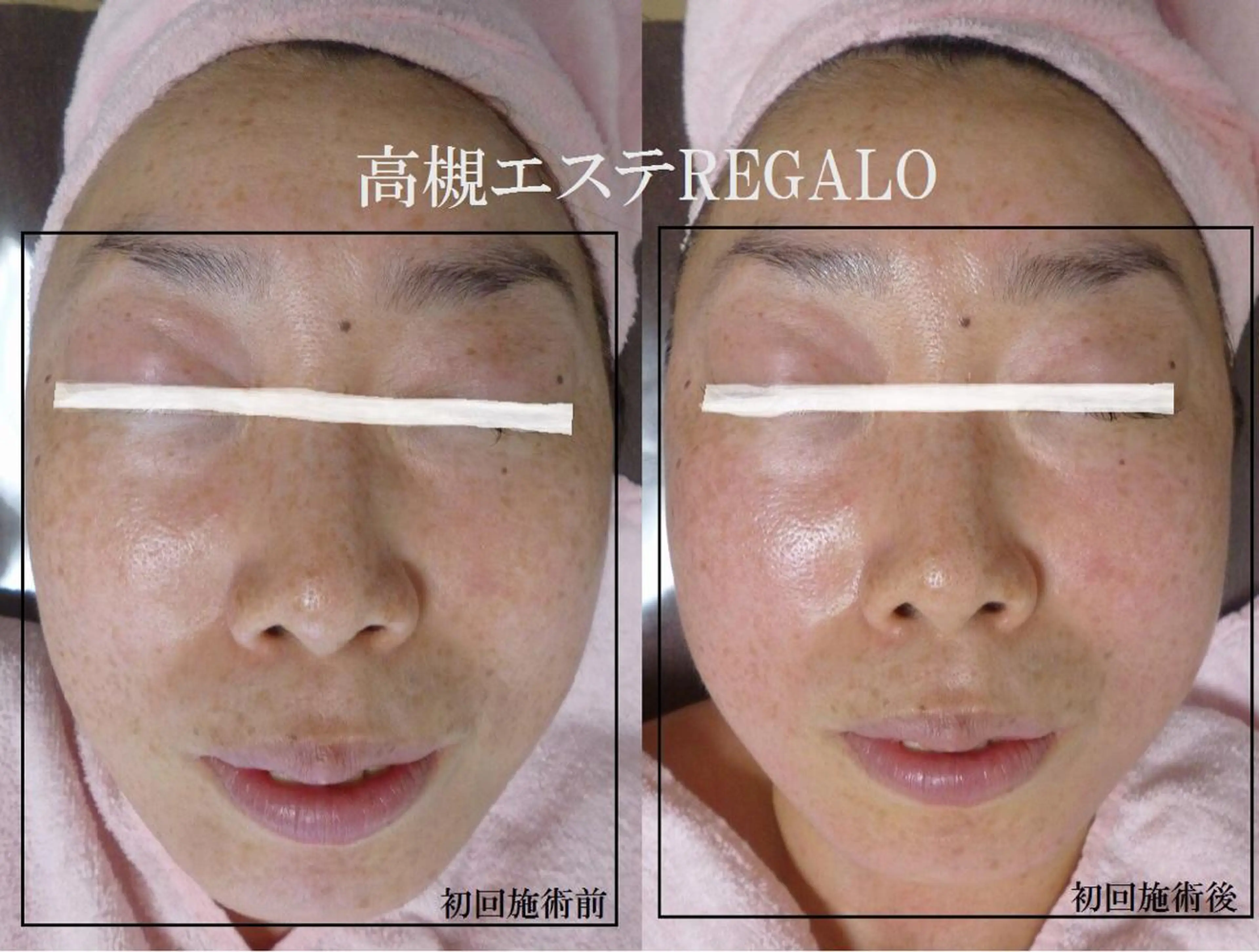 REGALO所属・矢野 さやかのエステ・リラクイメージ