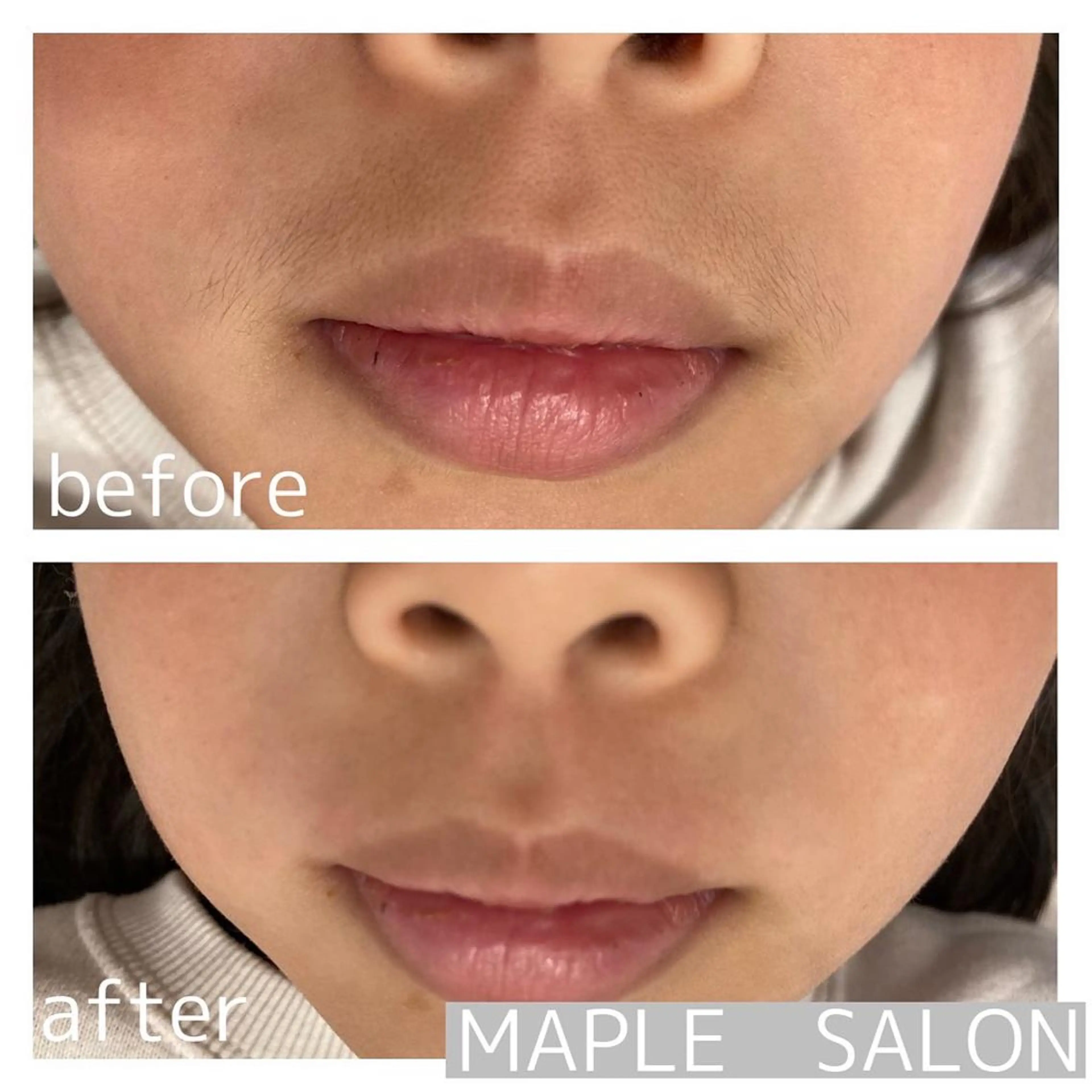 キッズ MARI シュガーリストのエステ・リラクイメージ