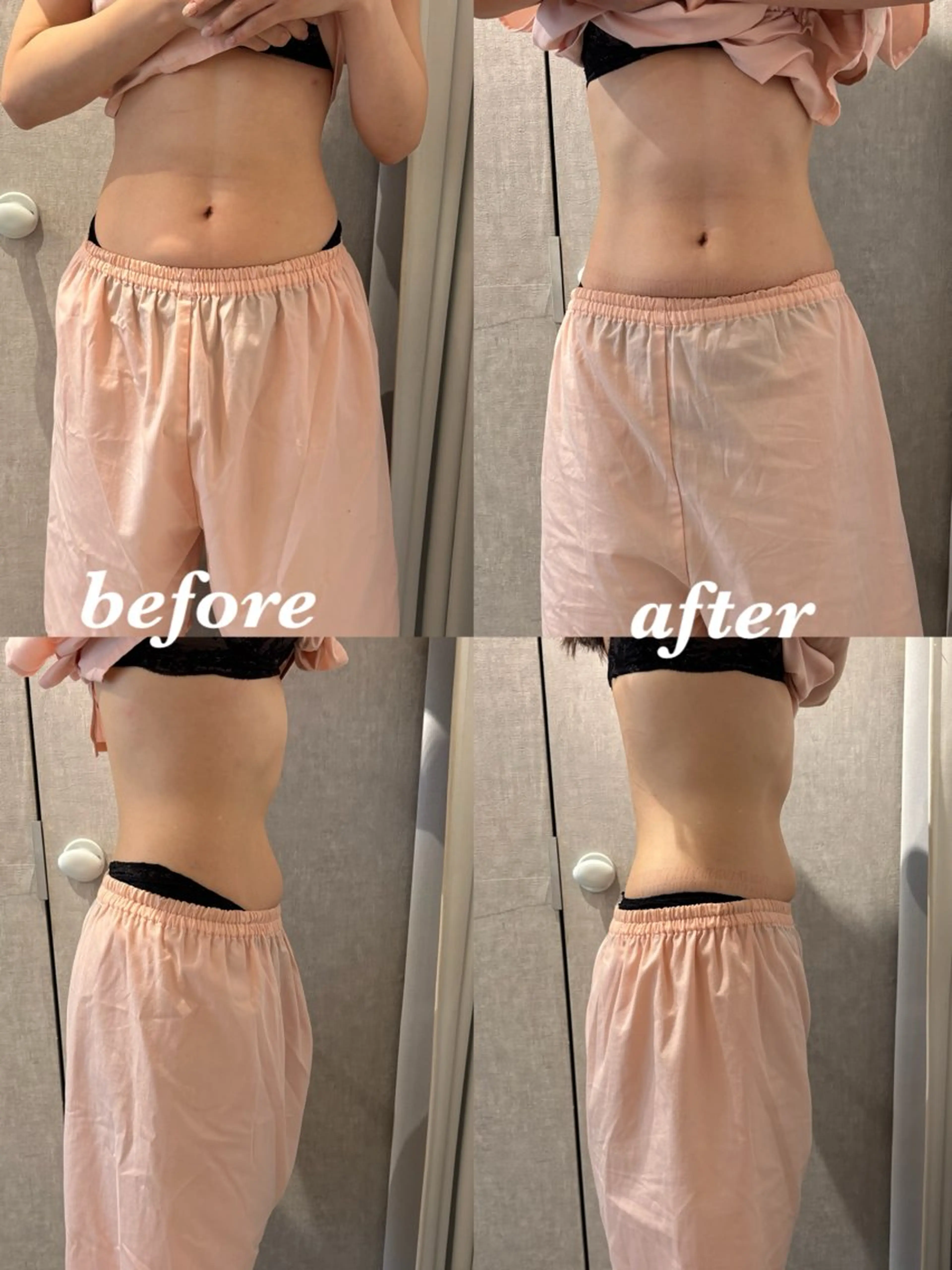 メンズ エステ リラク 腸活サポート みなみののエステ・リラクイメージ