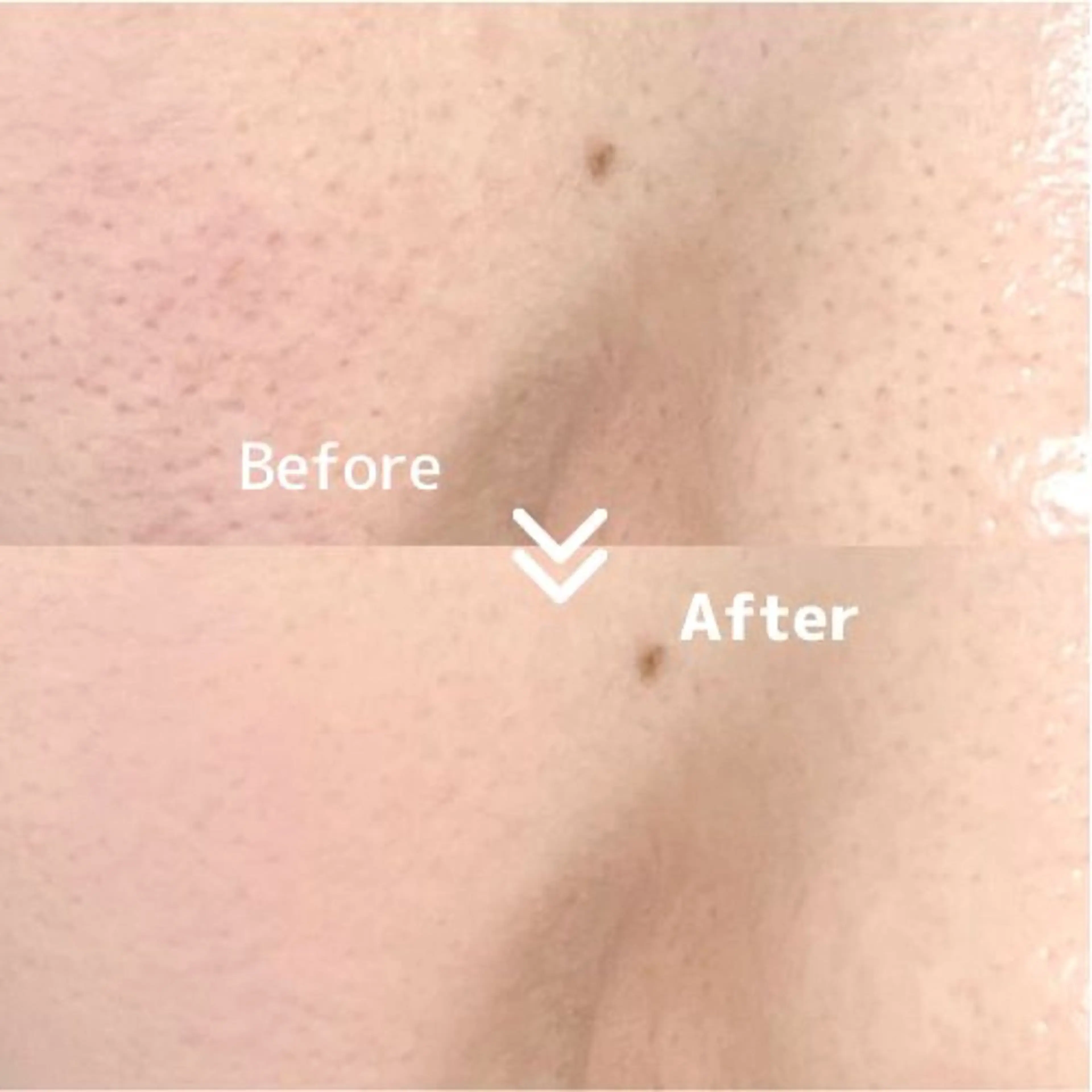 マツエク・マツパ エステ 愛維美水光美肌専門店所属・愛維美水光美肌専門店 メンズレディースokのエステ・リラクイメージ