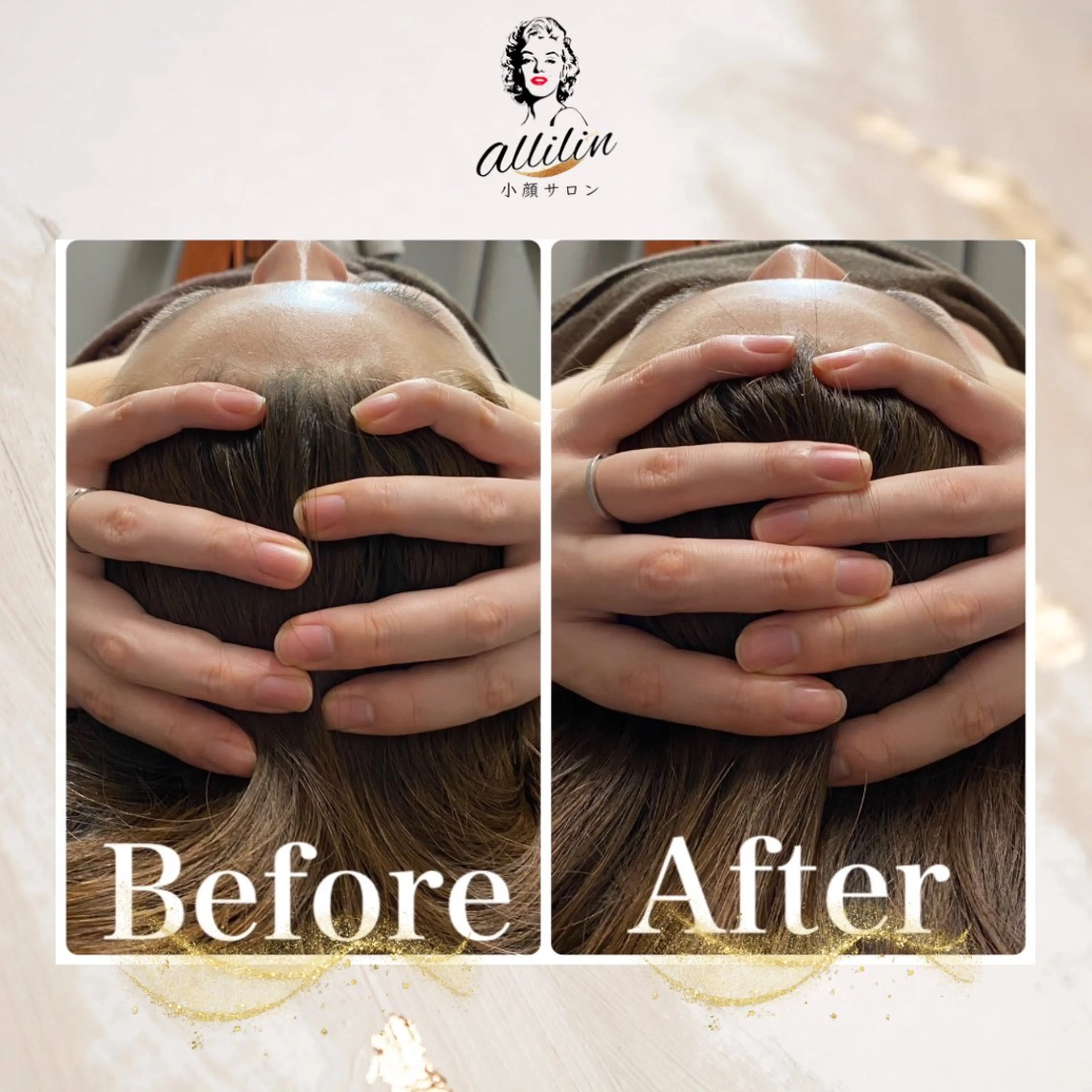 小顔サロンallilin所属・💎allilin 五所川原💎本間のエステ・リラクイメージ